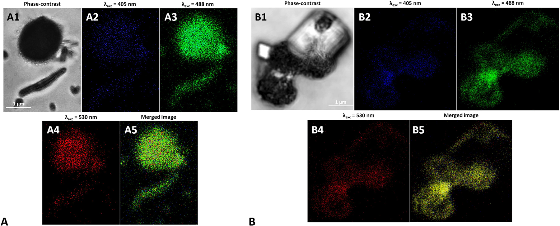 Figure 7: Super Resolution Confocal Microscopy images of (A) l-cys SeNPs_1:4 and (B) Bio SeNP extract_NB upon their excitation at (A2 and B2) 405, (A3 and B3) 488, and (A4 and B4) 530 nm. In (A1) and (B1) the phase contrast images of the samples are reported, while (A5) and (B5) show the photoluminescence merged images.
