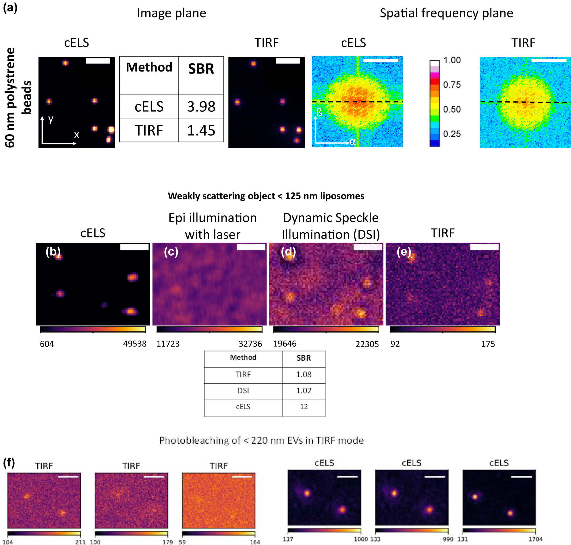 Figure 3:
Experimental results of weakly scattering specimens.
(a) cELS and TIRF images of 60 nm polystyrene beads. The signal to background ratio (SBR) is given in the table and the Fourier transform of the beads imaged using cELS and TIRF is given alongside. Scale bar 2 μm in the image plane (x–y plane) and 5 μm−1 in the spatial frequency plane (α–ß plane). The colorbar shows the intensity variation along the dotted lines in the Fourier plane. (b) Liposomes of <125 nm in size imaged using epi-illumination laser mode, (c) TIRF mode, (d) Dynamic Speckle Illumination mode and (e) cELS are compared. The colorbar shows the pixel values of the images. The corresponding SBR is given in the table below. Scale bar 2 μm. (f) cELS and TIRF images of <225 nm sized extracellular vesicles (EVs). The TIRF image shows photo-bleaching with time whereas cELS allows long-term imaging of the EVs. A larger field-of-view image of EVs is provided in Supplementary article, Figure S7. The colorbar shows the pixel values of the images. Scale bar 2 μm.