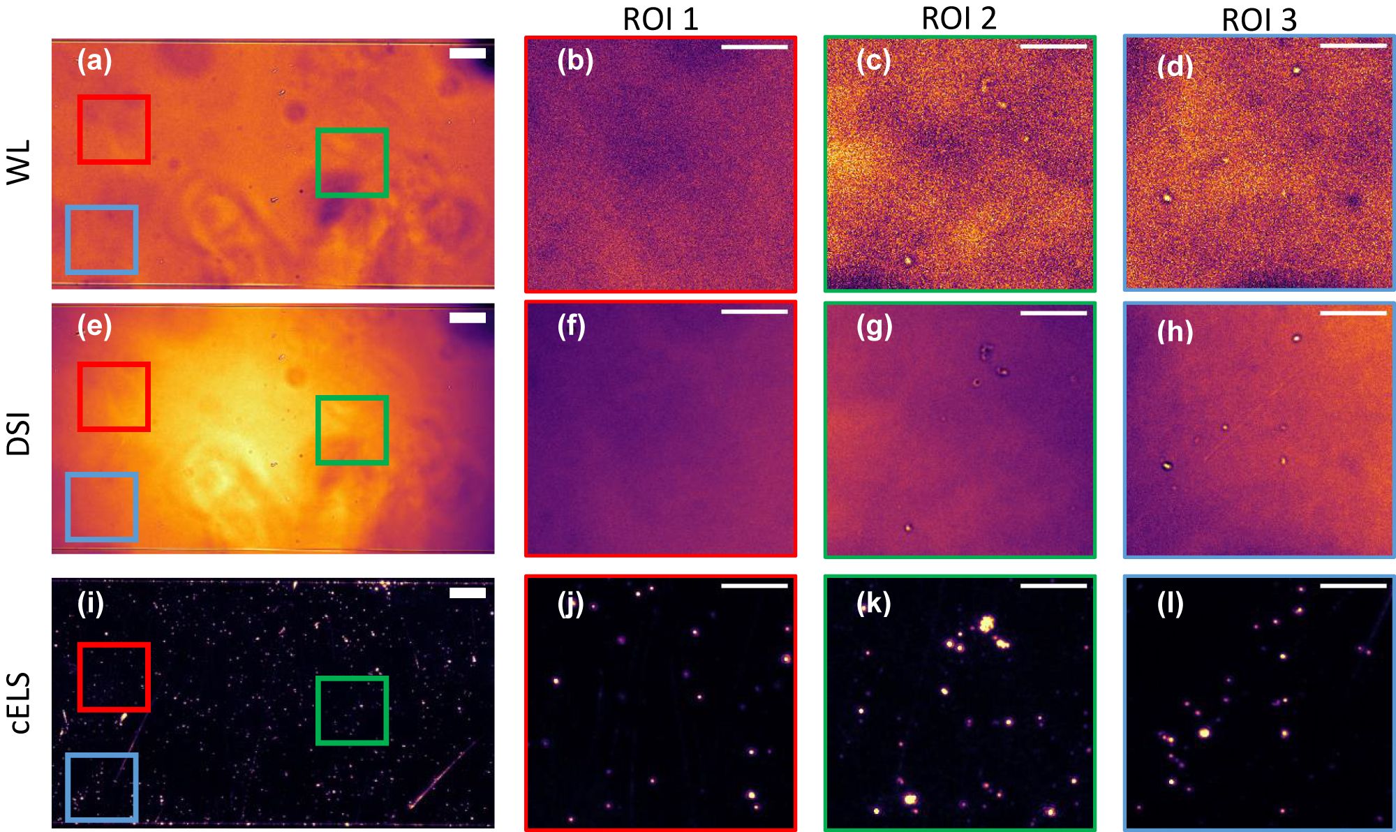 Figure 4:
100 nm polystyrene beads imaged using 20×/0.45NA with white light (WL), dynamic speckle illumination (DSI) and cELS.
(a, e, i) 100 nm beads imaged using WL, DSI and cELS respectively. Scale bar 50 μm. A few regions of interest, ROI 1–3, with aggregated and sparse beads are chosen within the FoV enclosed by red, green and blue boxes which are blown up and displayed. (b, c, d) WL images of 100 nm beads, (f, g, h) 100 nm beads imaged in DSI mode and (j, k, l) 100 nm beads imaged using cELS. Scale bar 20 μm in the blown-up regions.