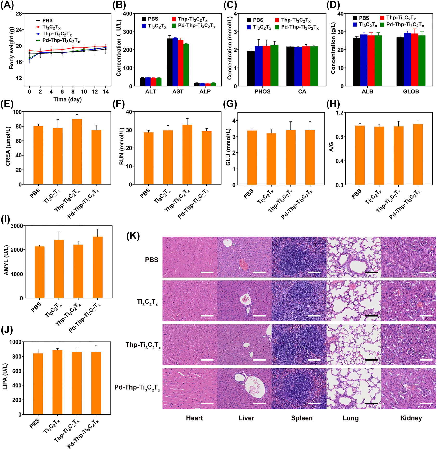 Figure 6: 

In vivo biosafety evaluation of various nanocomposites. (A) Time-related body weight of BALB/c mice after the intravenous administration with different nanocomposites. (B–J) Blood biochemical analysis of BALB/c mice after the intravenous administration with different composites at 14th day. (K) H&E-stained tissue sections of major organs from BALB/c mice in biosafety experiments (Scale bar: 100 µm).
