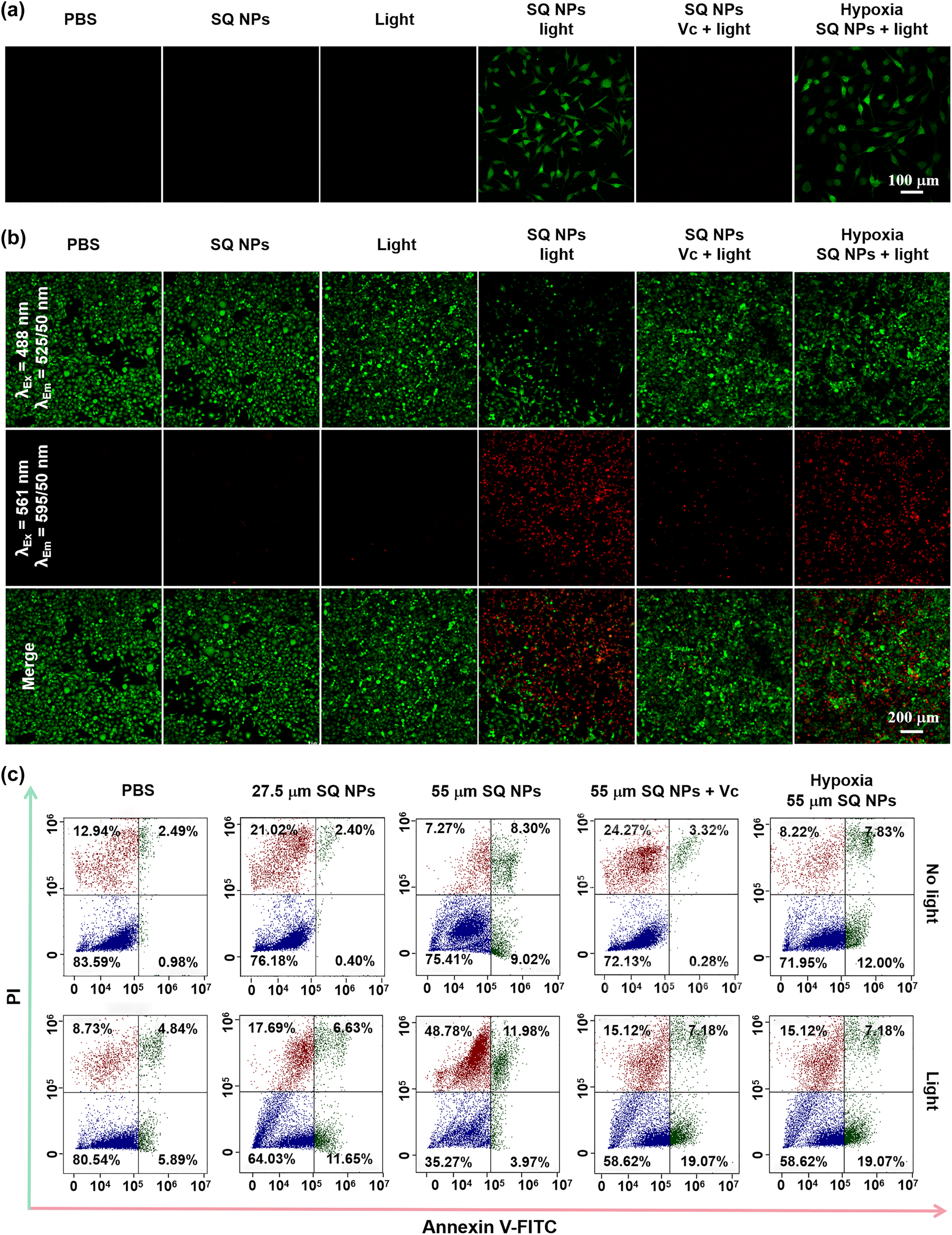 Figure 3:
ROS production and PDT capacity of SQ NPs in vitro samples. (a) ROS production capacity of SQ NPs in SH-SY5Y cells treated with (I) PBS, (II) SQ NPs, (III) light, (IV) SQ NPs + light, (V) SQ NPs + Vc + light and (VI) hypoxia SQ NPs + light. (b) PDT capacity of SQ NPs on SH-SY5Y with treatments: (I) PBS, (II) SQ NPs, (III) light, (IV) SQ NPs + light, (V) SQ NPs + Vc + light and (VI) hypoxia SQ NPs + light. (c) Apoptosis analysis of SH-SY5Y cells with various treatments. (Green channel: 500–550 nm, excited at 488 nm; red channel: 570–620 nm, excited at 561 nm).