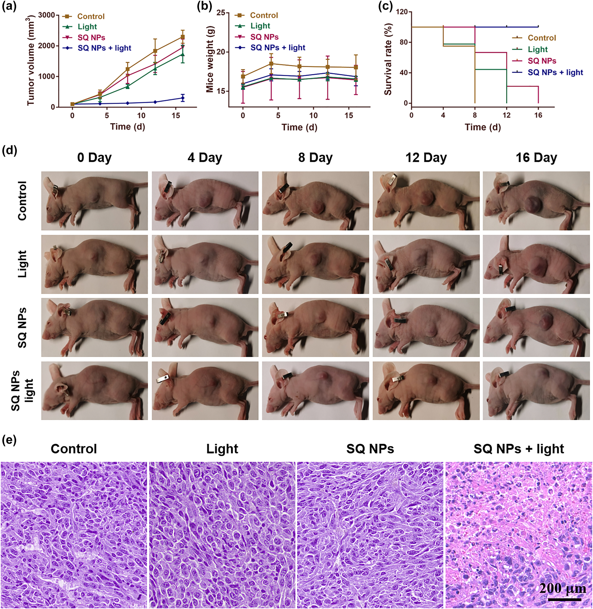 Figure 5:
In vivo PDT. (a) Tumor volume. (b) Mice weight. (c) Mice survival. (d) Tumor size. (e) Tumor section staining of mice with various treatments. The scale is 200 μm.