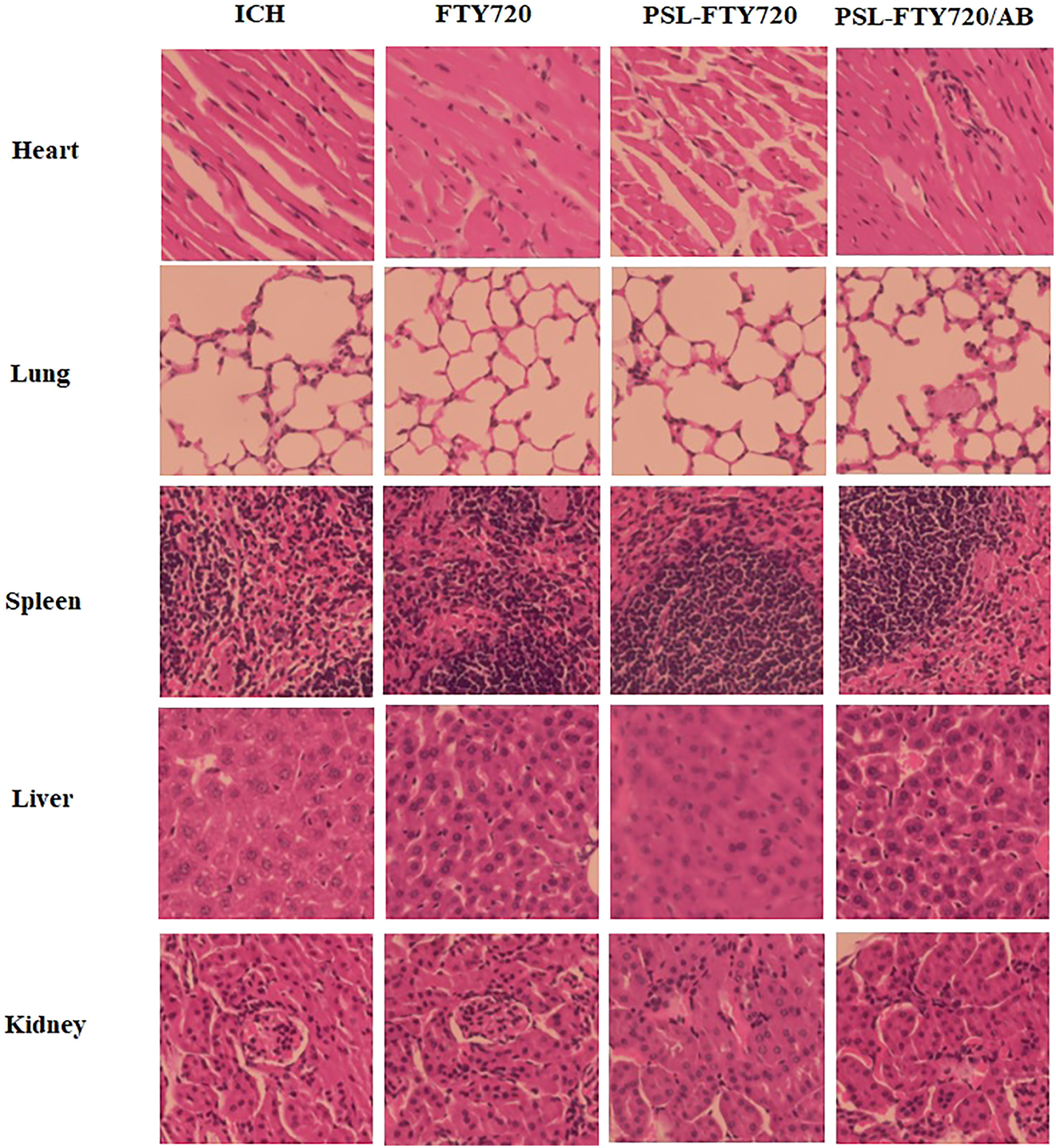 Figure 3:
H&E staining of main organs after administration of FTY720, PSL-FTY720 and PSL-FTY720/AB.