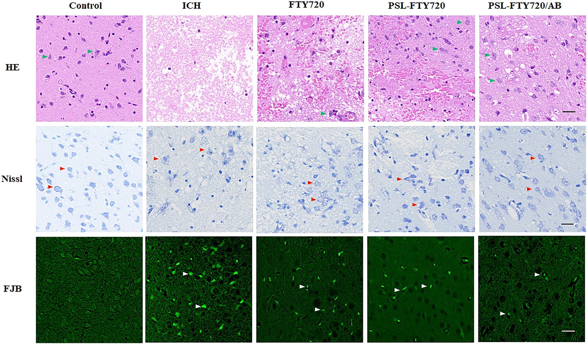 Figure 6:
Assessment of HE, Nissl and FJB staining in perihematomal tissue at 3d after ICH.