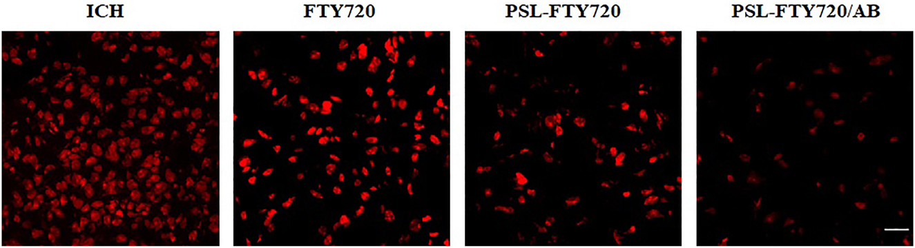 Figure 7:
Assessment of DHE staining in perihematomal tissue at 3d after ICH.