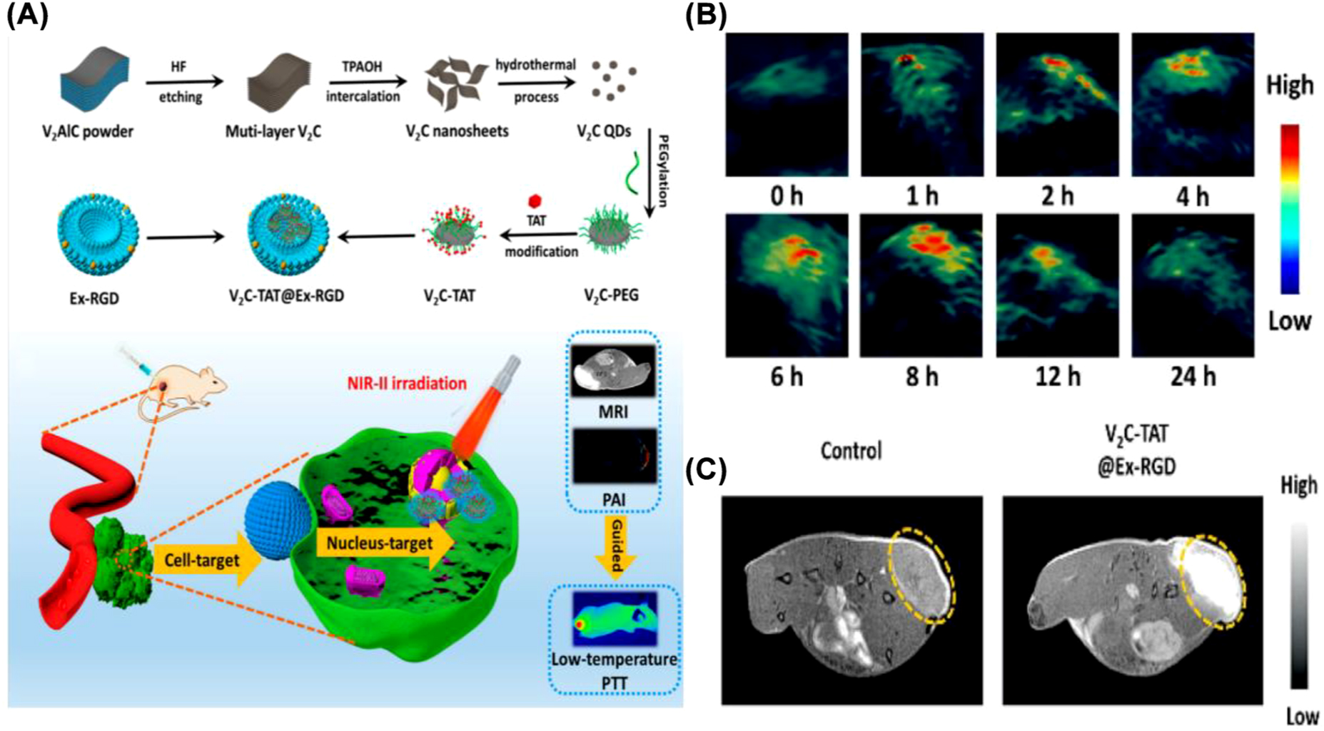 Figure 8: 
Multiple imaging capabilities of MXene. (A) Scheme of the synthesis and surface modification of V2C-TAT@Ex-RGD and multimodal imaging in NIR-II biological window combined with low-temperature PTT. (B) In vivo PA images of mice at different times after i. v. injection of V2C-TAT@Ex-RGD (V2C-TAT, 10 mg/kg). (C) MR images of mice after intravenous injection of PBS (left) and V2C-TAT@Ex-RGD (right) [34]. Copyright 2019, American Chemical Society.

