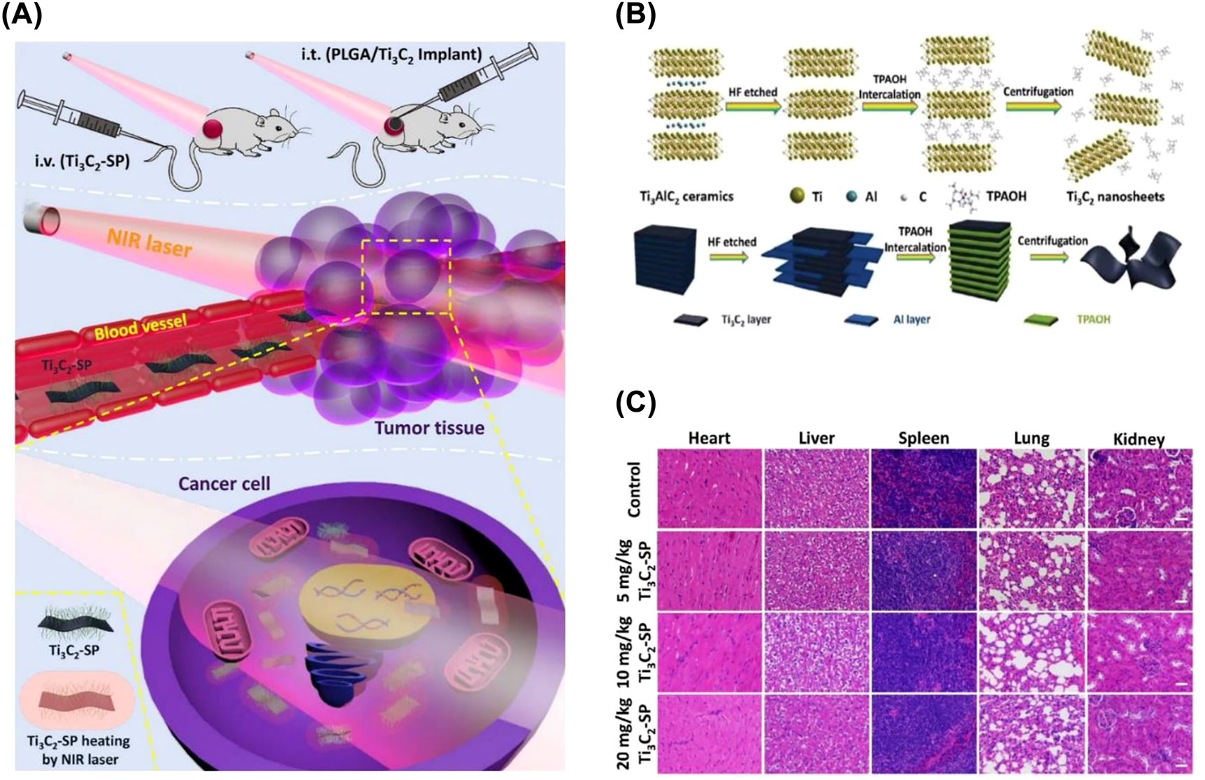 Figure 9: 
MXene for PTT. (A) Schematic representation of treatment with intravenous injection of Ti3C2-SP and intratumoral injection of PLGA/Ti3C2 implants under NIR laser irradiation. (B) Schematic illustration of the synthesis process of Ti3C2 nanosheet. (C) H&E staining of major organs (heart, liver, spleen, lung and kidney) in the control group and three treatment groups with different Ti3C2-SP doses (5, 10, and 20 mg/kg, respectively) [35]. Copyright 2017, American Chemical Society.
