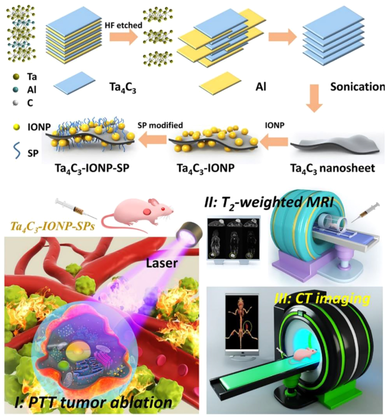Figure 12: 
Schematic representation of the construction of Ta4C3-IONP-SPs nanosheet and MRI/CT dual-modality imaging-guided tumor therapy [36]. Copyright 2018, Wiley-VCH.

