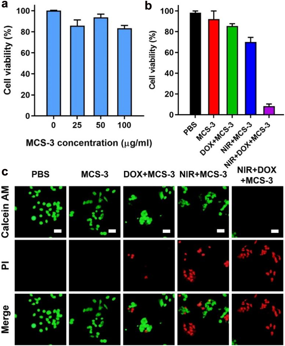 Figure 5:
CCK-8 assay results of KHOS cells incubated with MCS-3 under various concentrations ranging from 0 to 100 μg/mL for 24 h (a). In vitro cancer cell death after NIR photothermal ablation under different formulations (50 μg/mL) (b). Representative fluorescent microscopic images with Calcein AM/PI staining of live cells (green) and dead cells (red) from the corresponding formulations (c). All scale bars are 25 μm.