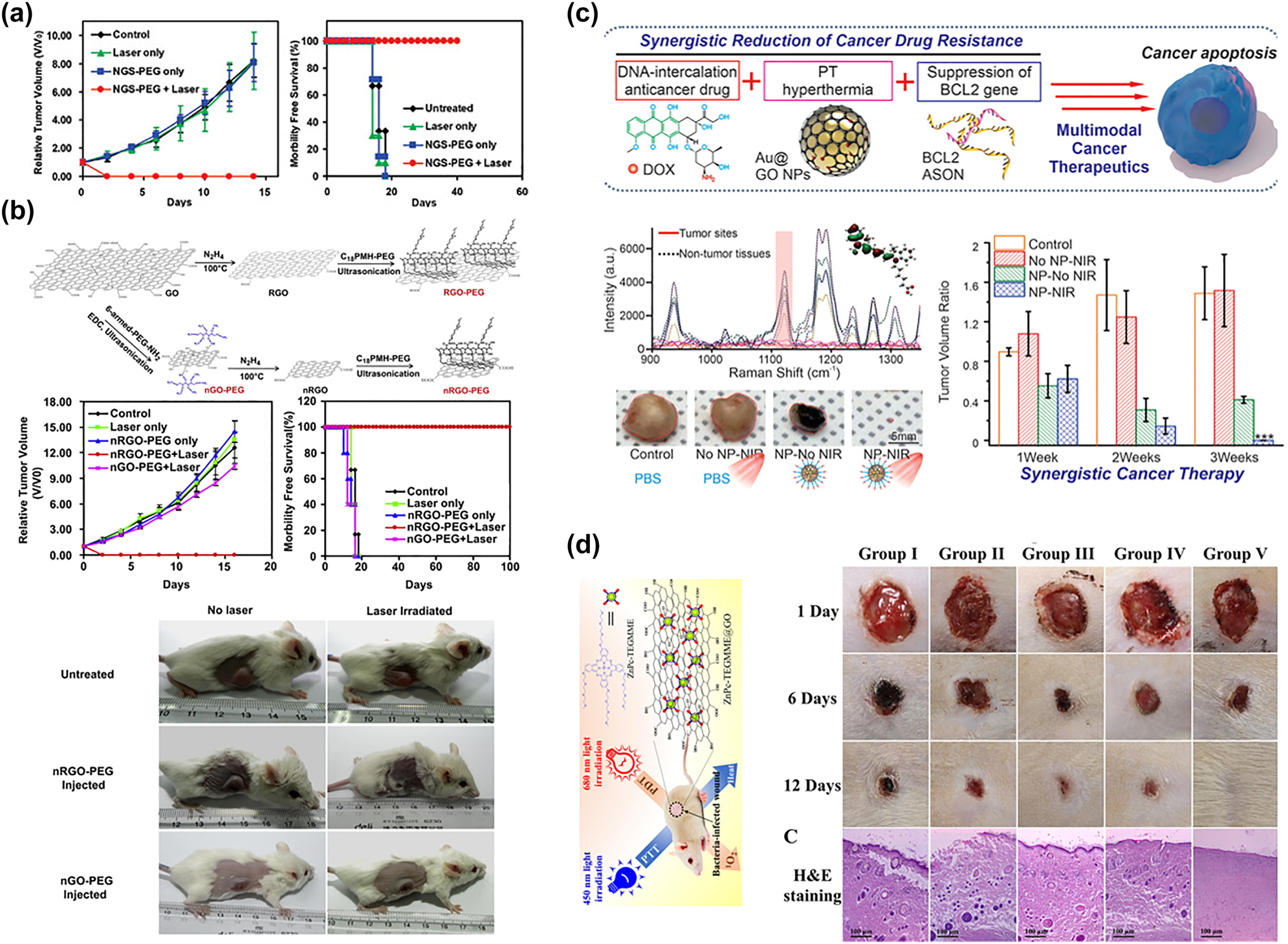 Figure 4: 
Graphene-based material for phototherapy: (a) PEG-nGO for PTT [84], Copyright 2022 American Chemical Society (b) rGO for PTT at low laser power [88], Copyright 2022 Elsevier publishing group. (c) PTT and CT ynergistic GO [67], Copyright 2022 John Wiley and Sons. (d) PTT&PDT GO for anti-bacterial [86], Copyright 2022 American Chemical Society.
