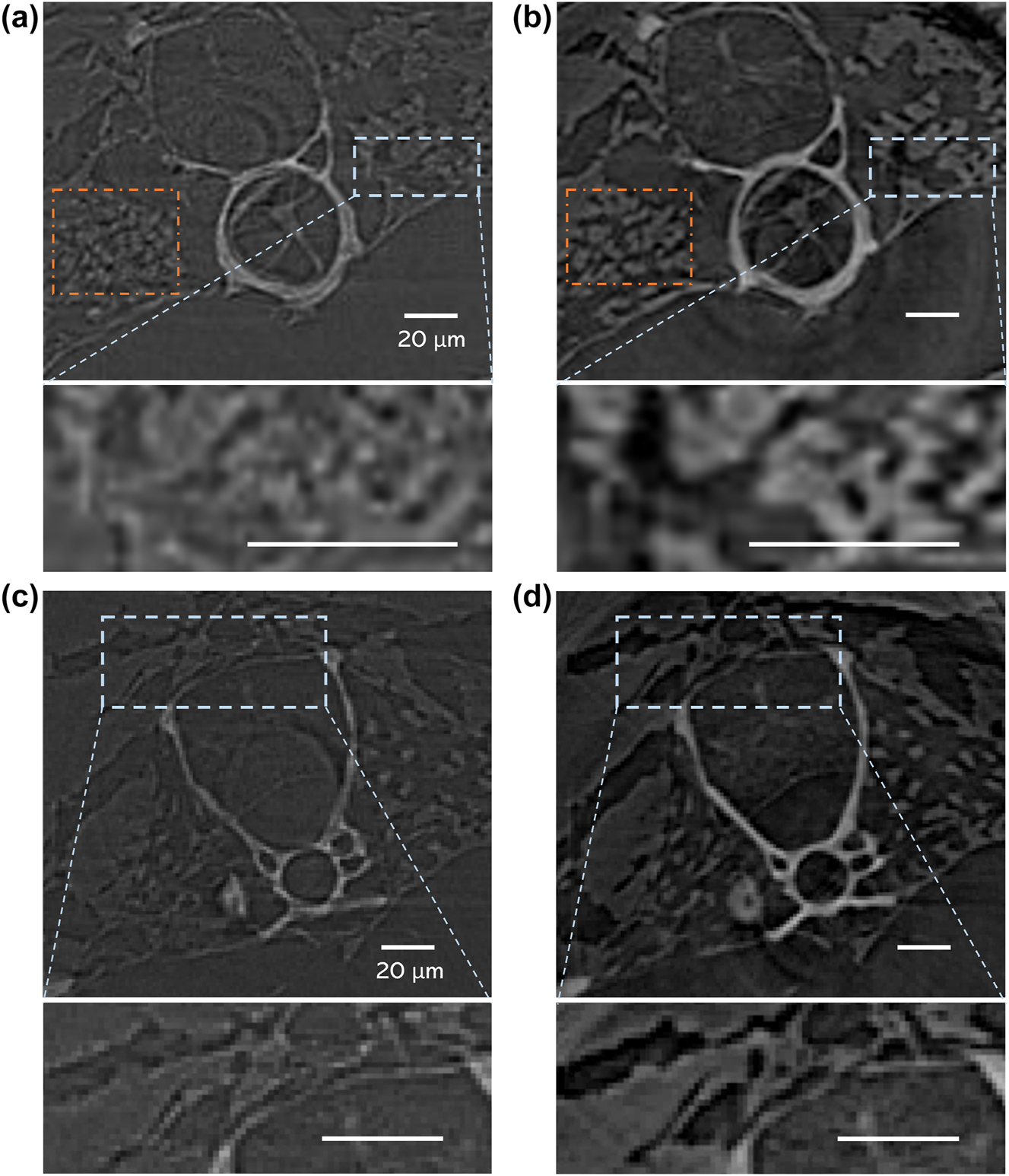 Figure 5: 
Tomography results for different X-ray imaging frameworks. Reconstructed slices and the enlarged view of the select area of the vertebra via (a) Nsys and (b) SysK

ξ3. Reconstructed slices and the enlarged view of the select area of the rib via (c) Nsys and (d) SysK

ξ3. The brightness of background noise is adjusted to the same level.

