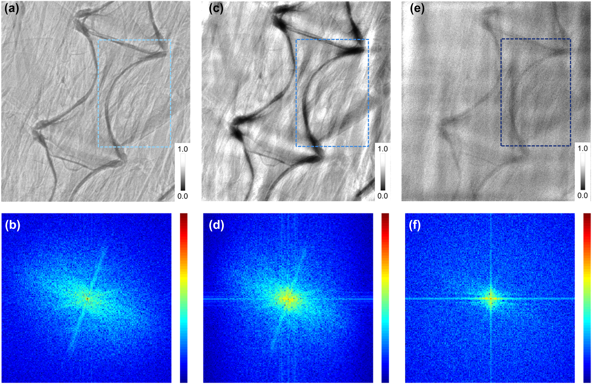 Figure 7: 
Spine images observed by different frameworks. (a) The spine image observed by a camera system equipped with a scintillator (direct imaging) and (b) the corresponding 2D Fourier transform spectrum, (c) by K

ξ3 and (d) the corresponding 2D Fourier transform spectrum, and (e) by K

ξ5 and (f) the corresponding 2D Fourier transform spectrum. The blue box indicates the contrast between the two different enhancement features.
