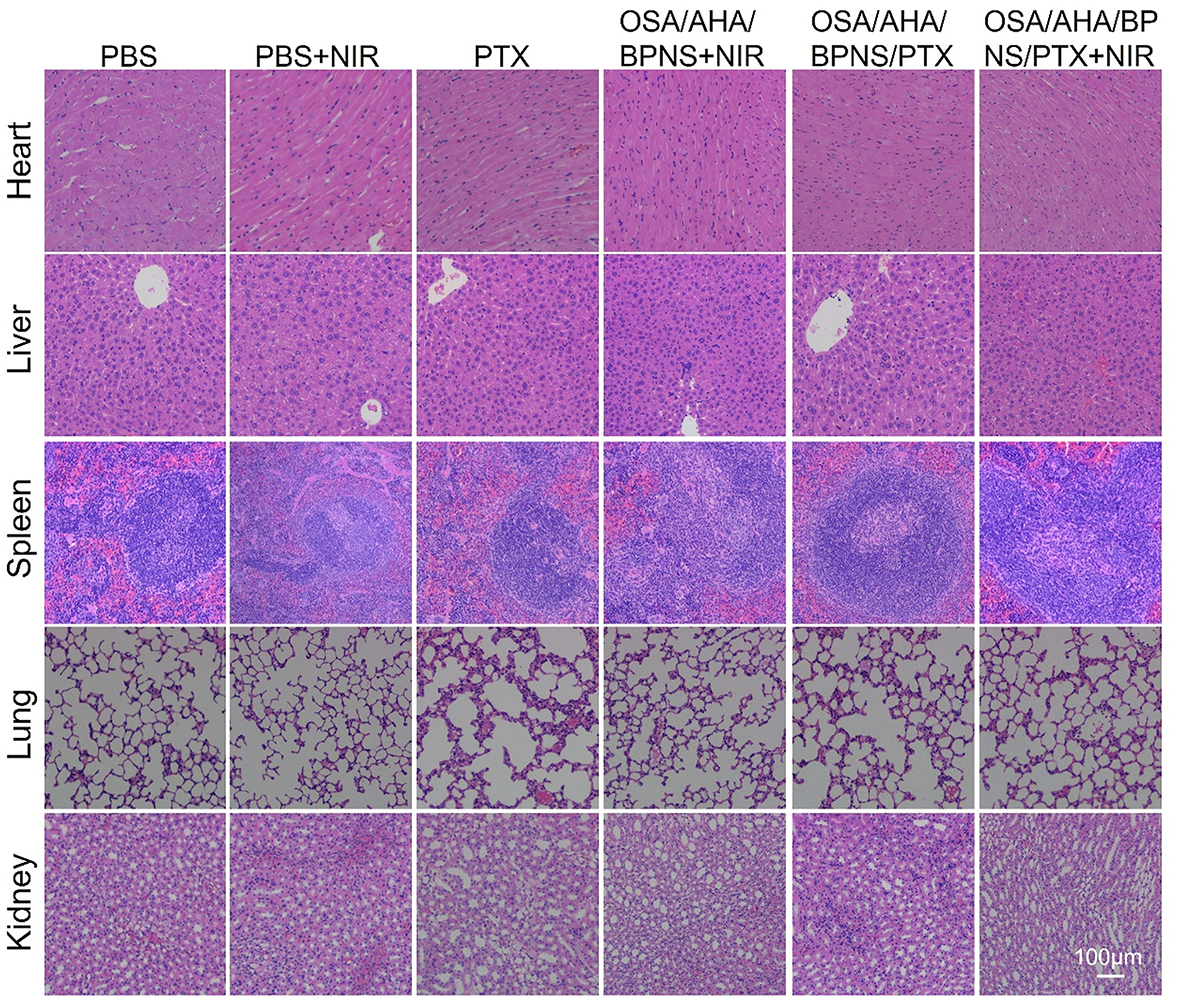 Figure 6: 

In vivo biocompatibility evaluation of materials, H&E staining images of mice organs underwent different treatments for 14 days. Note that 1–6 represent mice groups with different treatment.
