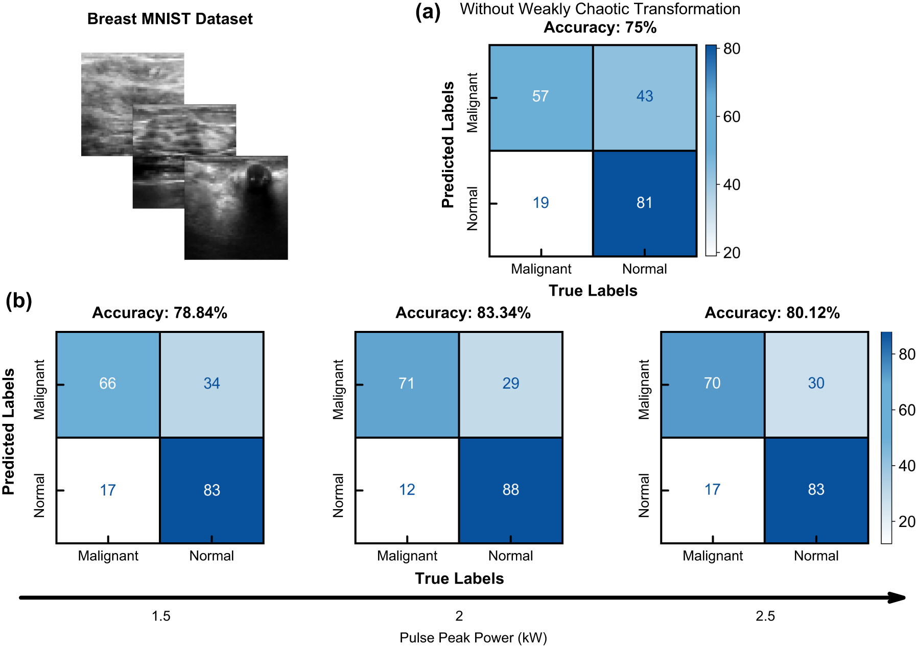Figure 4: 
Binary classification results utilizing breast MNIST dataset. (a) Confusion matrix of baseline ridge classification accuracy without chaotic transformation. (b) Confusion matrices of ridge classification after chaotic transformation with different input pulse peak powers.
