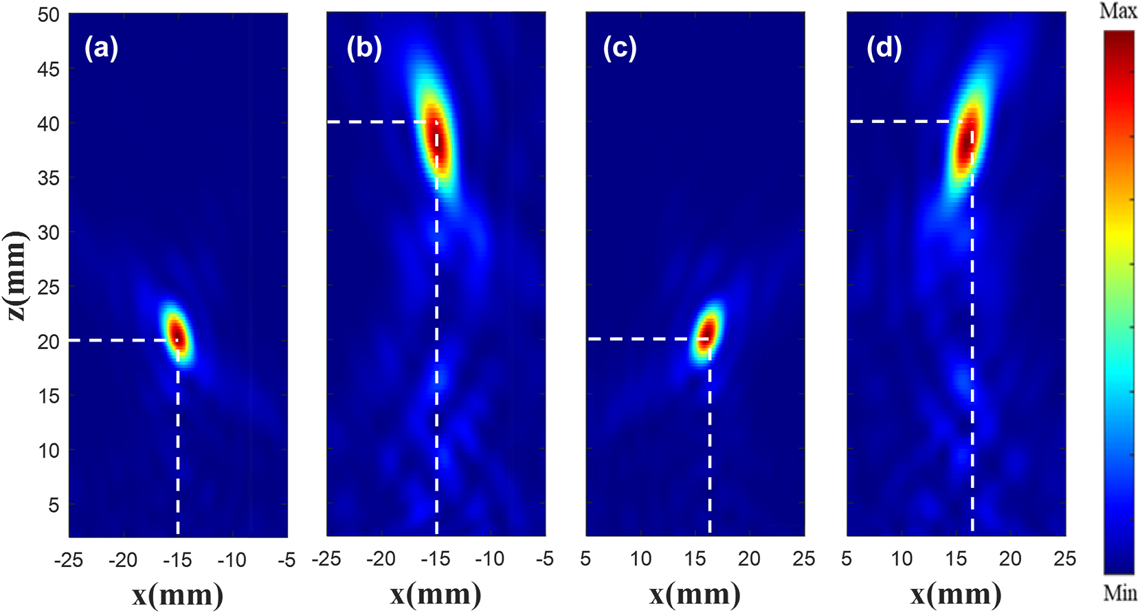 Figure 9:
|E|2 diagram at each focus. Existing (a) and customized (b) |E|2 diagram at the focus (−15 mm, −15 mm). Existing (c) and customized (d) |E|2 diagram at the focus (16 mm, 16 mm).