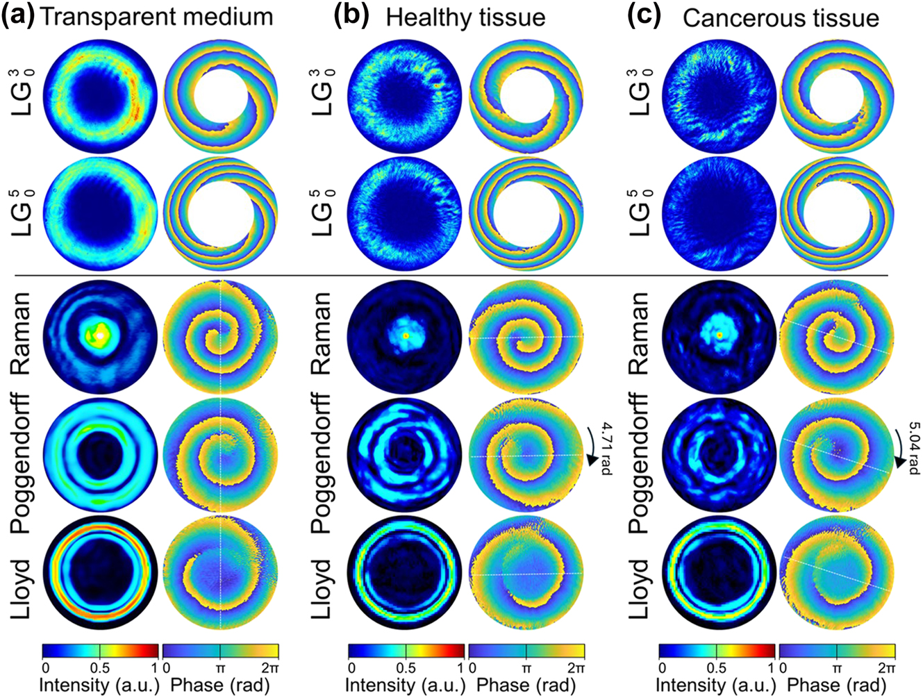 Figure 8: 
Beam intensity and phase profiles of LG and CR: Lloyd, Poggendorff and Raman propagating through 5 μm-thick transparent medium (a), normal tissues (b), and cancerous tissues (c).
