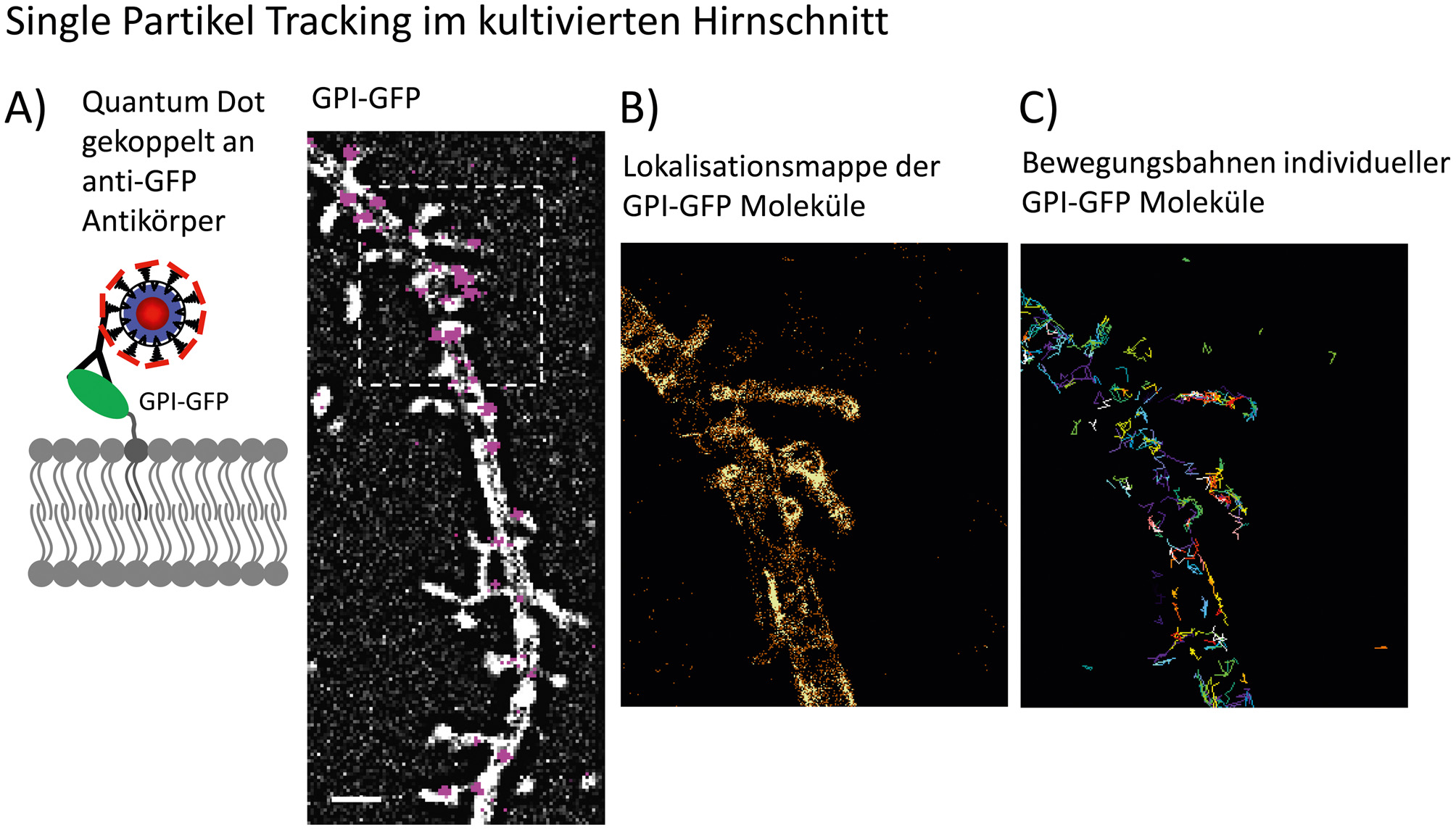 Abb. 2: Single Particle Tracking in kultivierten Hirnschnitten. A) Schematische Darstellung eines lipidverankerten GFPs, welches über einen monoclonalen anti-GFP – Antikörper mit einem Quantum Dot (QD) markiert ist. Quantum Dots sind Einzelphotonen – Emitter, die durch ihre lang anhaltende Fluoreszenz und dem stochastischen Blinken den Vorteil bieten, sie als einzelne Fluorophore zu erkennen. Des Weiteren haben QDs ein sehr breites Anregungsspektrum. Diese Eigenschaften ermöglichen es, einzelne QDs zweifelsfrei zu detektieren. B) Im Bild sind die Positionen einzelner Qantum Dots auf den mit GPI-GFP transfizierten Dendritensegment eine hippocampalen Nervenzelle gezeigt. Die Verfolgung individueller QDs über die Zeit ermöglicht die Darstellung der äußeren Membran, basierend auf der Lokalisation der QDs über die Zeit (hier 1.000 Bilder über 30 s). C) Die Rekonstruktion der Bewegungsbahn ist oft durch das Blinken der QDs oder die Überschneidung der Lokalisation benachbarter Partikel unterbrochen, wobei ein Teil der Lokalisationen nicht für die Rekonstruktion der Trajektorien verwendet werden kann. Für weitere Informationen siehe auch (Biermann et al., 2014).