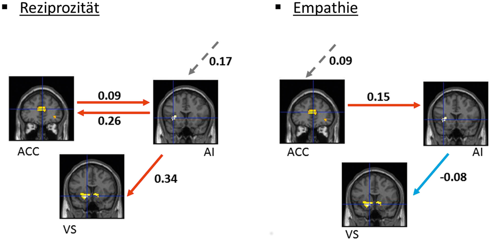 Abb. 3:  Befunde einer Beispielstudie, welche unterschiedliche Motive anhand von neuronalen Konnektivitäten klassifizierte. Durchgestrichene Pfeile zeigen an, wie stark das Ausmaß der Aktivierung einer Region die Aktivierung einer anderen Region verändert (Effektive Konnektivität). Gestrichelte Pfeile zeigen Veränderung der Aktivierung innerhalb einer Region in Abhängigkeit von der experimentellen Manipulation (Input) an. Die Zahlen sind Modell-Parameter, die die Stärke der effektiven Konnektivitäten oder Inputs reflektieren. ACC = anteriorer zingulärer Kortex, AI = anteriore Insel, VS = ventrales Striatum.
