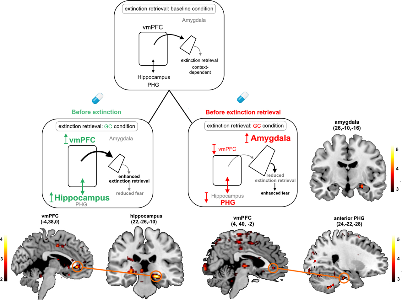 Figure 3: 
Simplified scheme of the neural network mediating extinction retrieval under baseline conditions (upper panel) and the proposed neural mechanisms underlying the effects of glucocorticoids (GCs) on this network, when administered before extinction learning (lower left panel) or before extinction retrieval (lower right panel). Neural activation and functional connectivity are additionally shown for the comparison between conditioned stimuli in the respective brain regions. The ventromedial prefrontal cortex (vmPFC) and the hippocampus are activated and determine, based on the given context, whether or not extinction memory is expressed under nonstressful (baseline) conditions. However, if cortisol was administered before extinction learning, activity of the hippocampus and its functional connectivity to the vmPFC increases in a later retrieval task, leading to enhanced extinction retrieval and thus reduced fear. In contrast, exposure to cortisol before the retrieval task itself suppresses vmPFC activation and its connectivity with the parahippocampal gyrus (PHG), enhances activation of the amygdala, and leads to impaired extinction retrieval and thus enhanced fear. The size of the structures indicates activation dominance. The colors of the arrows depict the proposed modulating influence (black = modulation; gray = reduced modulation by GCs; green = enhancing GC effects; red = impairing GC effects). Reprinted from Meir Drexler et al. (2019), Copyright (2019), with permission from Elsevier.
