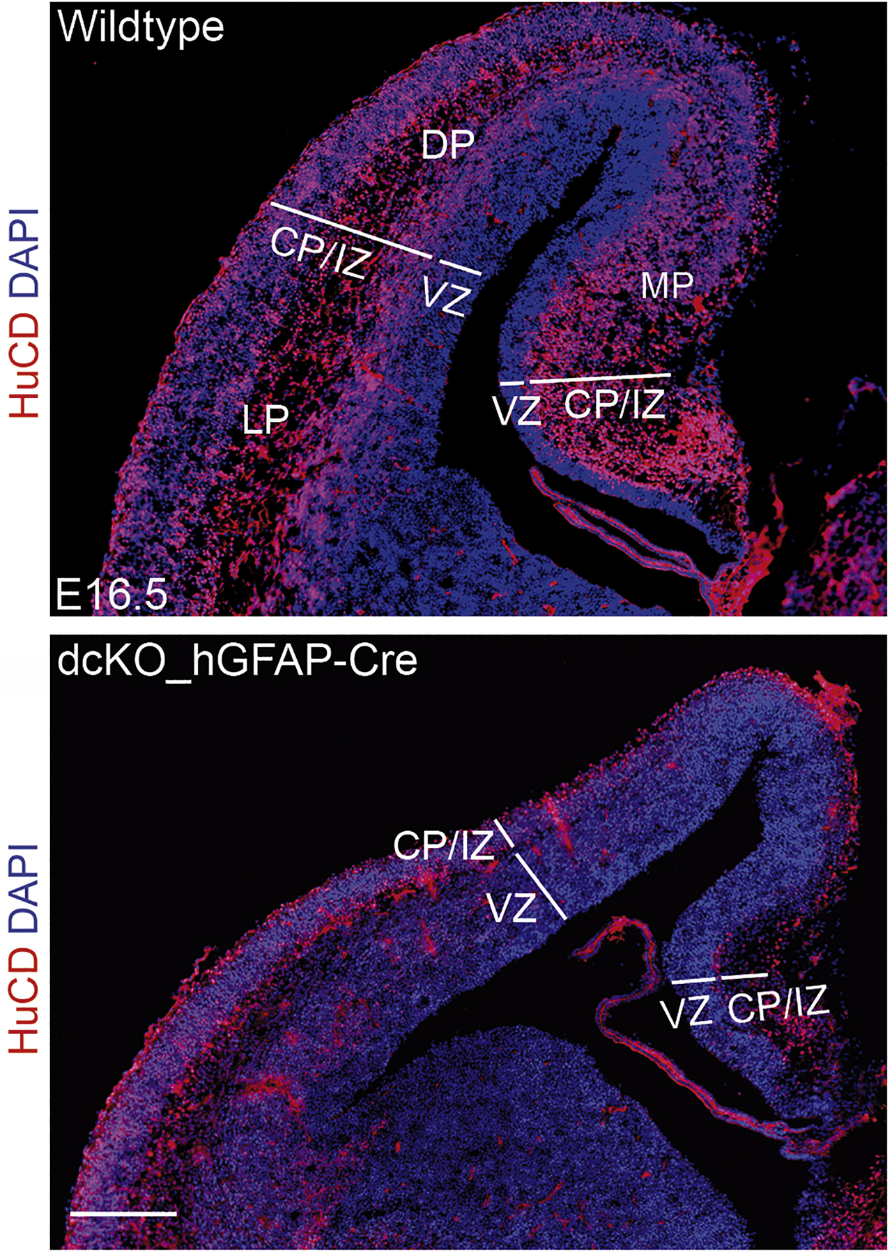 Figure 4: 
Loss of BAF155 and BAF170 in the early cortical anlage leads to a diminished thickness of the cortical plate at later embryonic stages. Immunofluorescence staining for the neuron-specific RNA-binding protein HuC/D (ELAV; red) in the cortices of E 16.5 wild-type mice and littermates double mutant for BAF155 and BAF170 under control of the human GFAP promoter. CP, cortical plate; DP, dorsal pallium; IZ, intermediate zone; LP, lateral pallium; MP, medial pallium; VZ, ventricular zone; Scale bar represents 100 mm. Picture courtesy of Tran Tuoc, Göttingen.
