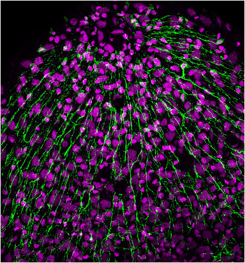 Figure 4: Modern microscopy technologies allow analysing the complex anatomy of the Hydra nerve net with unprecedented resolution. Here, the cell bodies and neurites of RF-amide-positive neurons in the hypostome (green) are visualized using a specific antibody. Cell nuclei are counterstained with TO-PRO (magenta).