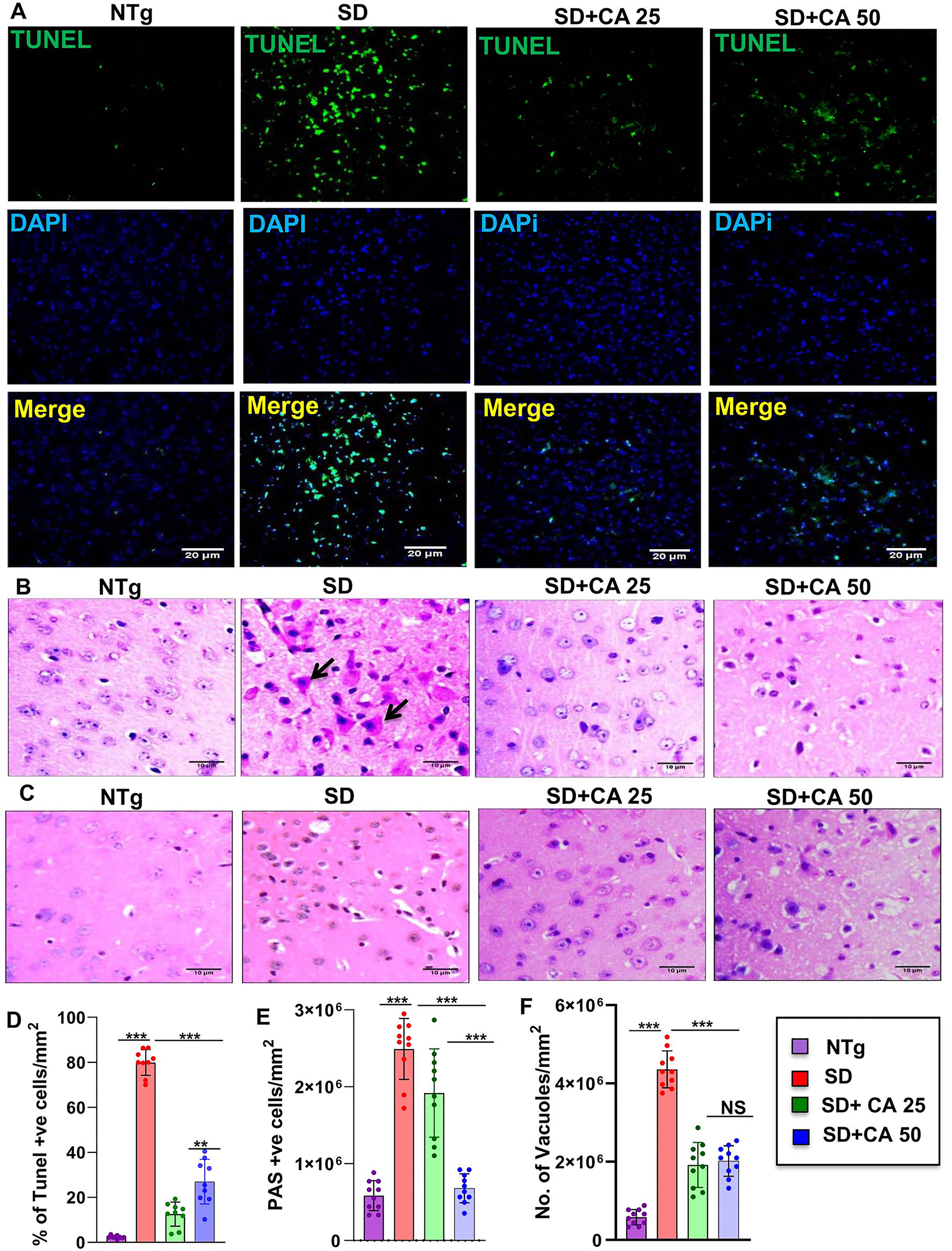 Figure 3: 
Treatment with CA attenuates neuronal apoptosis and reduces glycoconjugates in Sandhoff mice. Three-months-old SD mice (n=6/group) were treated with two doses of CA (25 and 50 mg/kg/day) solubilized in 100 µL 0.5 % methylcellulose via oral gavage. Therefore, control TS mice received 100 µL 0.5 % methylcellulose as vehicle. After 2 months of treatment, cortical sections were stained for TUNEL (A). The TUNEL (+ve) cells were expressed as % age of total cells per square mm (B). Paraffin embedded cerebral cortex sections were subjected to periodic acid-Schiff (PAS) stain for analyzing glycolipids (C). The glycoconjugate material-stained magenta is shown by arrow and quantified for PAS +ve cells per mm square (D). Paraffin embedded sections were also subjected to H & E staining as characterized by large vacuoles (thick arrows), pyknotic nuclei and swollen neuron in TS mice (E). The number of vacuoles were quantified per mm square (F). Results represent counting of 9–10 different sections from a total of 3 mice (n=3) per group. All data represents mean ± SEM. All statistical analysis was performed by one-way ANOVA followed by Dunnett’s multiple comparison test. *p<0.05; ***p<0.001.
