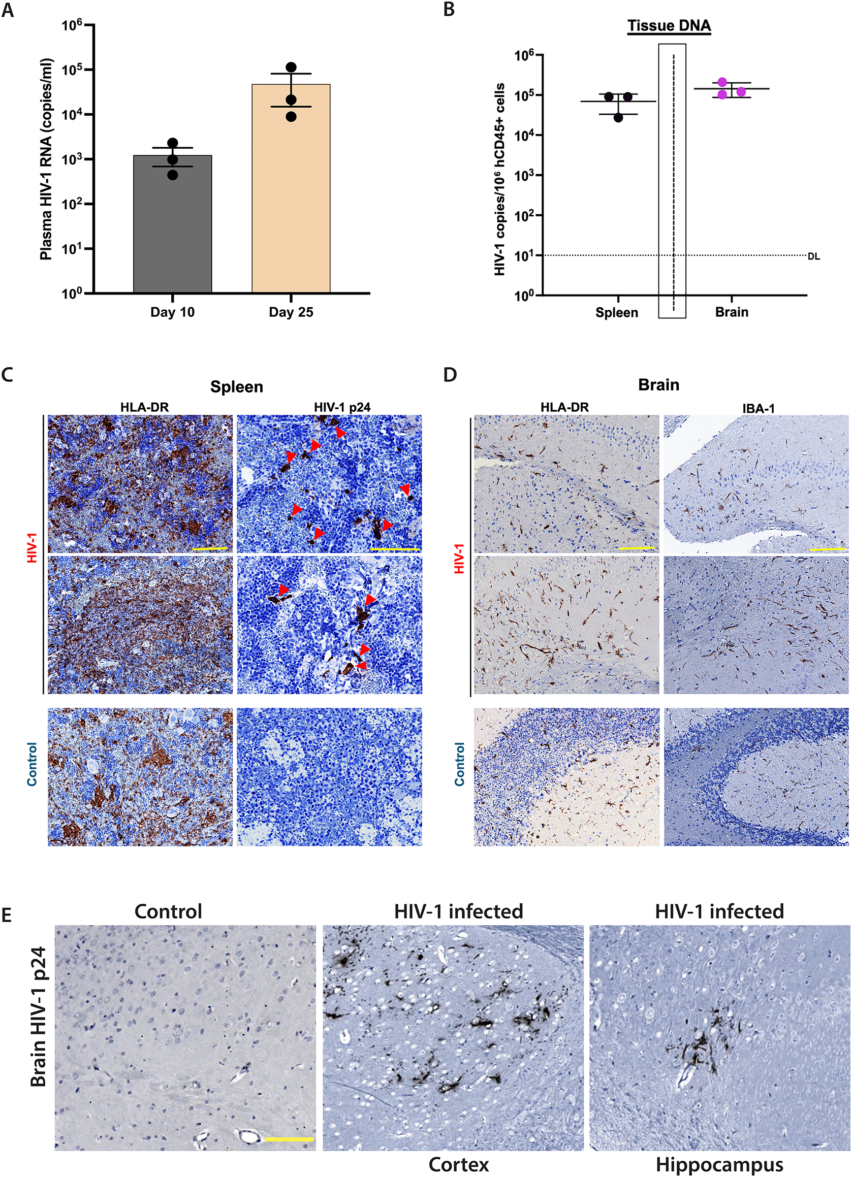 Figure 2:
Immune-reconstituted NAIL mice support productive HIV-1 infection. NAIL mice were infected with 104 TCID50 HIV-1ADA and monitored for 25 days of infection before termination. HSC reconstituted NAIL mice treated with sterile saline served as uninfected controls. (A) Plasma HIV-1 RNA levels were determined on days 10 and 25 post-infection to measure viral load and disease progression. The detection limit (DL), 200 RNA copies/ml. (B) DNA was isolated from brain and spleen cells on day 25 post-infection. HIV-1 DNA levels were determined and normalized to the number of human CD45+ cells to indicate reservoir establishment after infection. Detection limit (DL), 10 DNA copies/106 CD45+ cells. Tissue sections of spleen and brain were prepared from NAIL mice on day 25 post-infection or from uninfected controls. (C) Spleen sections were immunostained for expression of HLA-DR and HIVp24 (red arrowheads) to confirm productive HIV-1 infection in lymphoid tissues. (D) Brain sections were immunostained for HLA-DR and IBA-1 to validate the development of human microglia-like innate immune cells. (E) Immunohistochemical staining images of brain sections from control and HIV-1 infected NAIL mice stained for HIV-p24 protein. Positive HIV-p24 staining confirms productive viral infection in the brain. Scale bars, 100 μm.