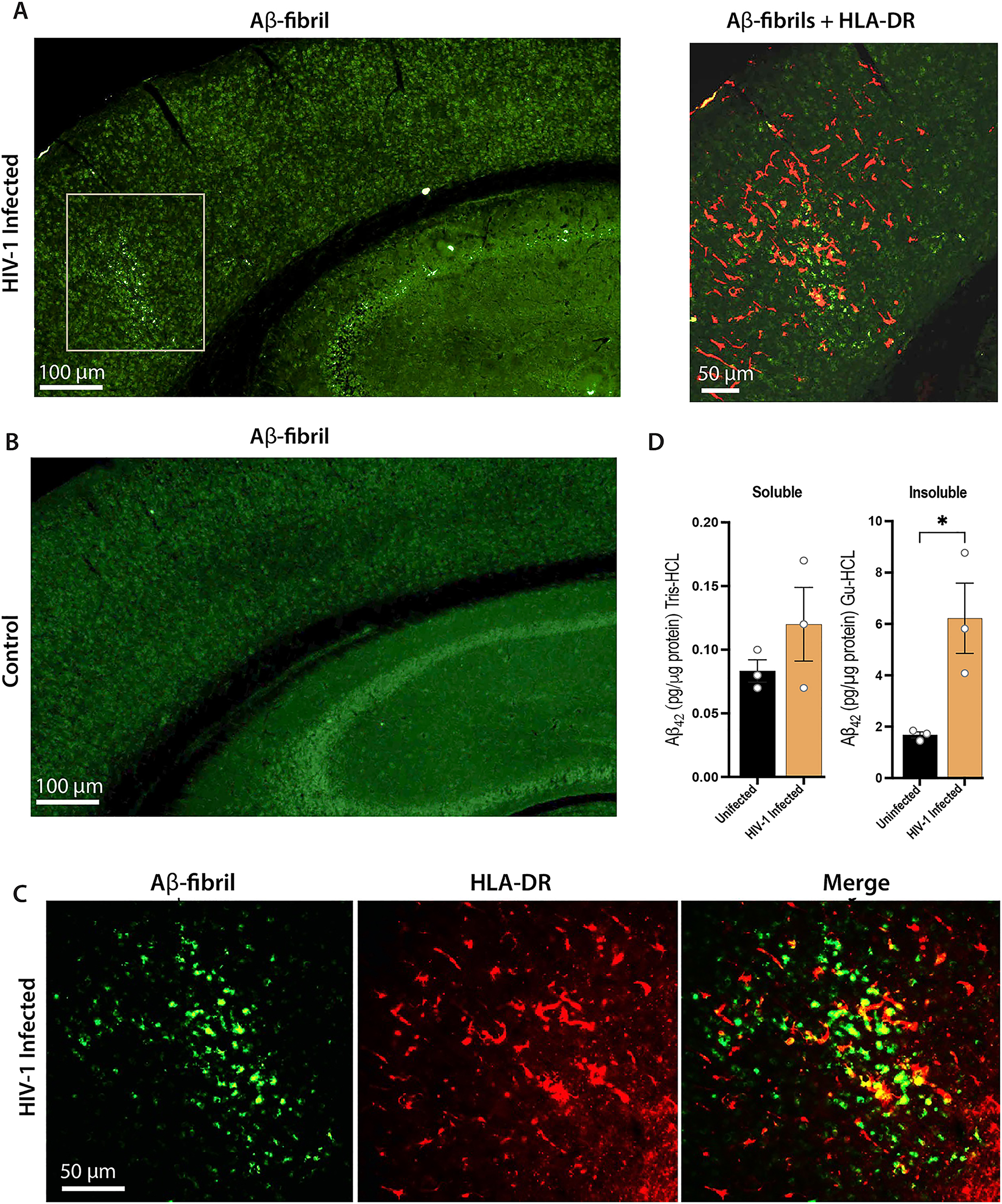 Figure 3:
NAIL mice permit simultaneous measures of HIV-1 infection and AD pathobiology. NAIL mice were infected with 104 TCID50 HIV-1ADA or treated with saline as uninfected controls. Both groups were terminated at day 25 post-infection and sections of brain were evaluated by immunofluorescence. (A) Low (left panel) and high power magnification (right panel) of brain sections from HIV-1 infected NAIL mice stained for Aβ fibrils (OC antibody, green) denoted by gray box or both Aβ fibrils and HLA-DR (human immune cells, red) in the right panel. Scale bars, 100 μm (left panel) and 50 μm (right panel). (B) Brain sections from uninfected control stained for Aβ fibrils (OC antibody, green). Scale bar, 100 μm. (C) High power magnification of brain sections from HIV-1 infected NAIL mice stained for Aβ fibrils (OC antibody, green) and HLA-DR showing co-localization of human immune cells with Aβ-fibrils. Scale bar, 50 μm. (D) Cortical brain tissues from uninfected and day 25 HIV-1 infected NAIL mice were dissected, lysed, and fractionated by differential centrifugation. Soluble (Tris-HCl) and insoluble (Gu-HCl) lysate fractions were evaluated for Aβ42 levels by ELISA. Means ± SEM and significant differences were determined for three mice per group whereby *p≤0.05.