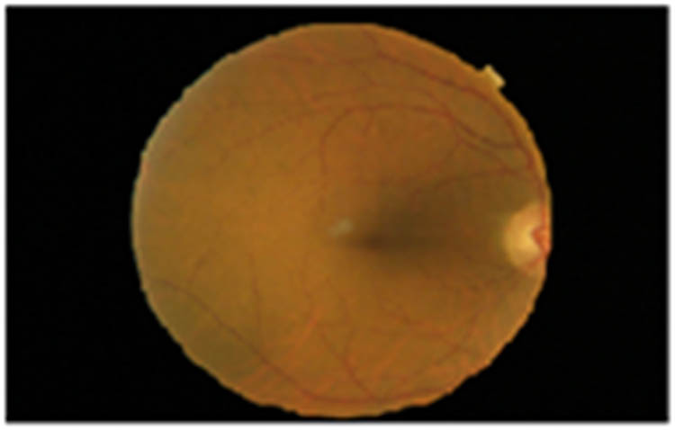 Figure 2 
               Input image.
            