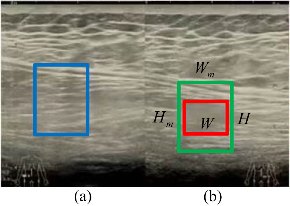 Figure 6 
                  Candidate area (a) and reference area (b) for damaged areas.
               