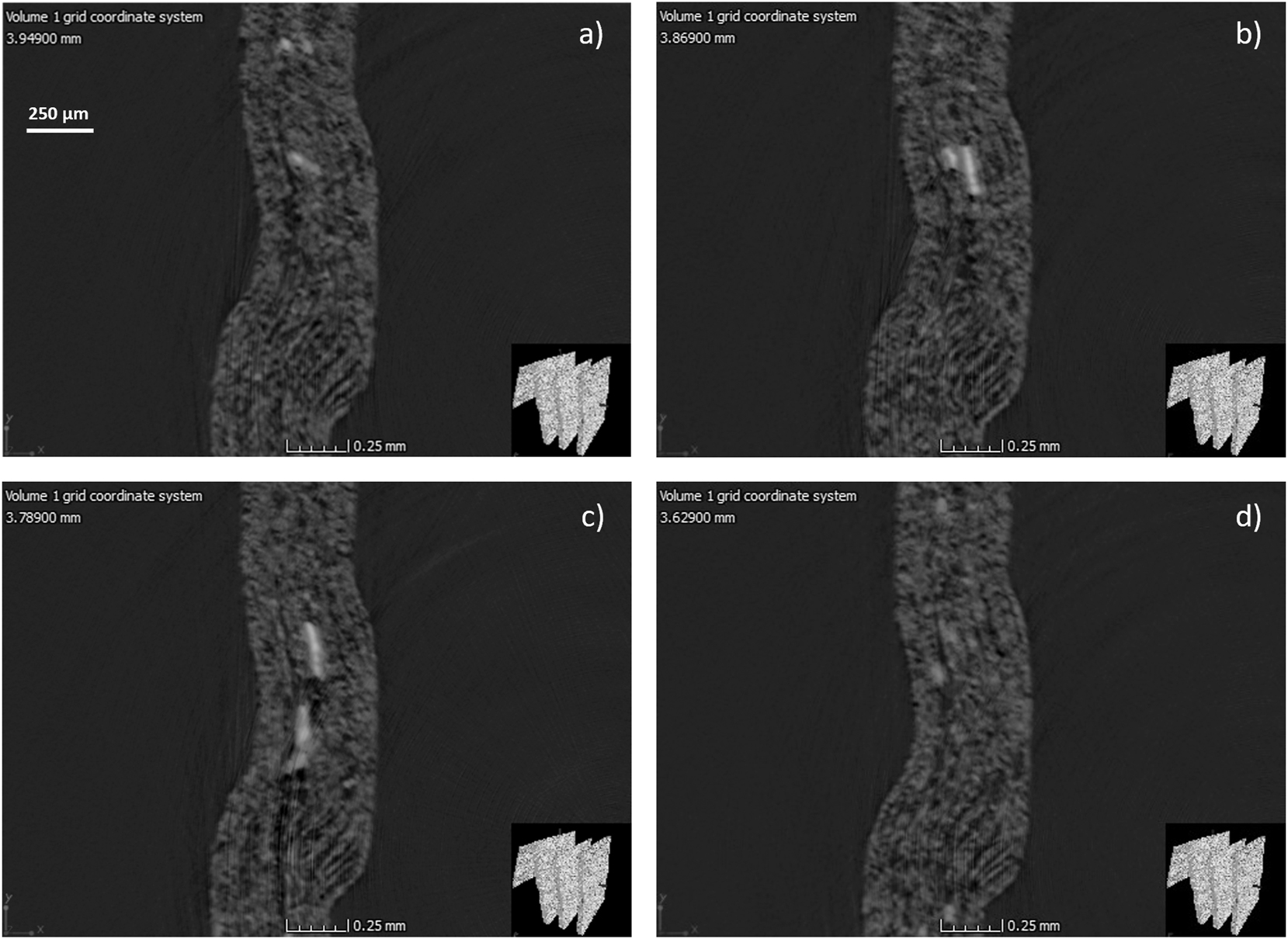 Figure 12: 
TOP-view cross-sectional images of a broke particle at different positions along the crease line: (a) Initial appearance, (b) 0.08 mm from (a), (c) 0.16 mm from (a), and (d) 0.32 mm from (a).
