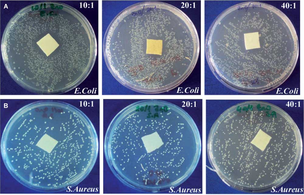 Figure 6 Antibacterial activities of the nanoZnO-coated textile samples with 10:1, 20:1, and 40:1 of the Zn+2:copolymer ratio against E. coli (A) and S. aureus (B). Reprinted from Coll. Surf. A: Physicochem. Eng. Aspects., 2012, vol. 414, Cakir BA, Budama L, Topel O, Hoda N, Synthesis of ZnO nanoparticles using PS-b-PAA reverse micelle cores for UV protective, self-cleaning and antibacterial textile applications, pages 132–139, Copyright (2012), with permission from Elsevier.