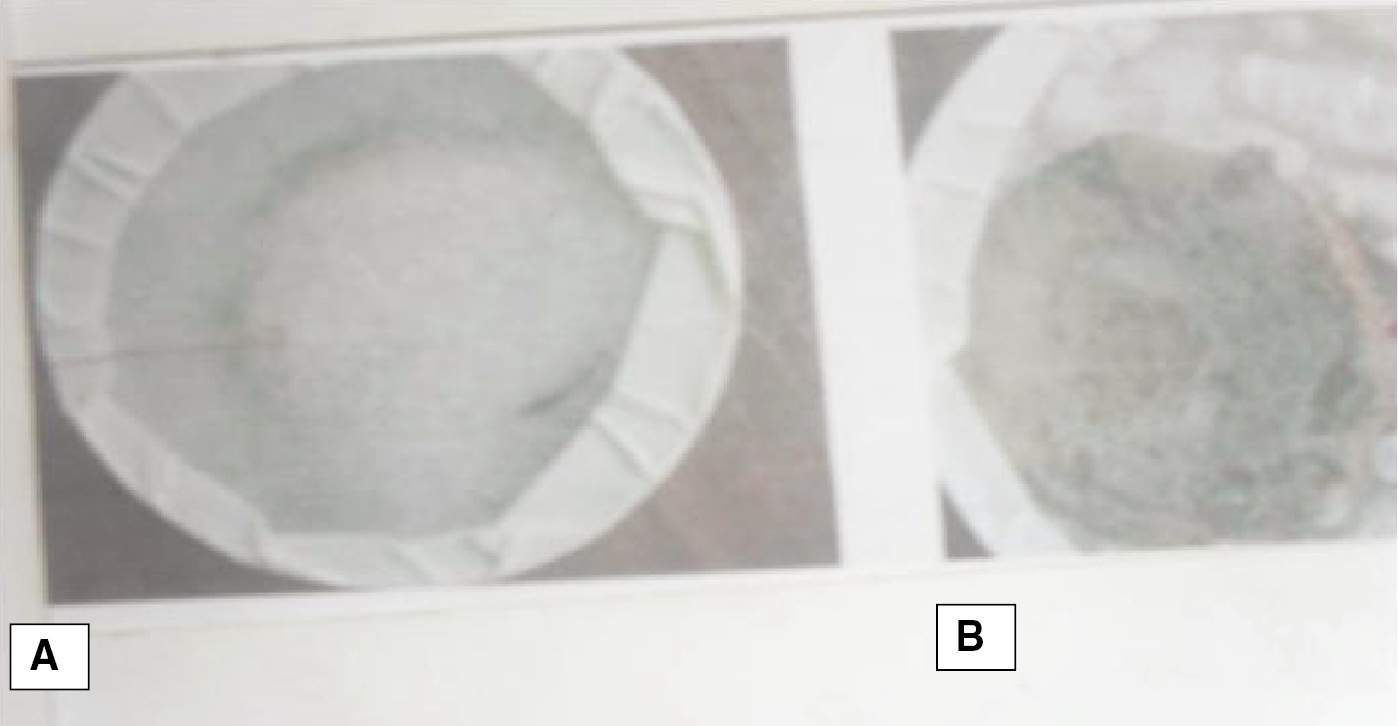 Figure 6: Photograph of untreated tuber (A) and tuber treated with AgNeemnano solution (B) against Fusarium moniliforme and Lasiodiplodia theobromae.