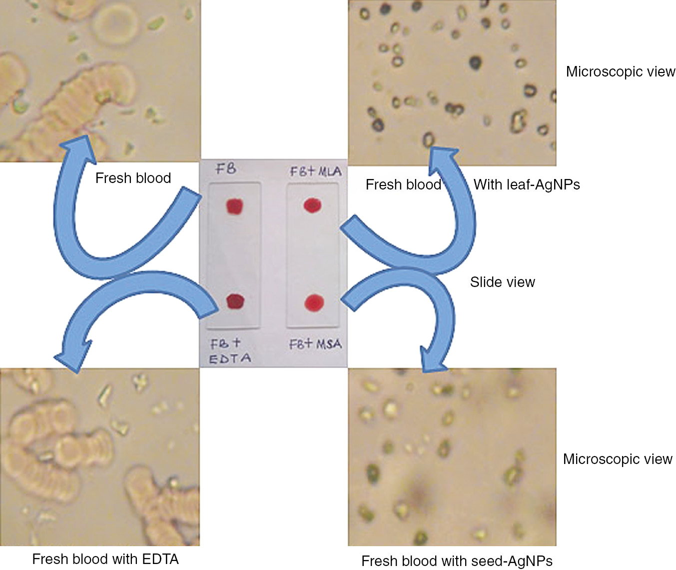 Figure 8: Blood anticoagulant activities of the biosynthesized AgNPs using leaf and seed extracts of S. dulcificum.