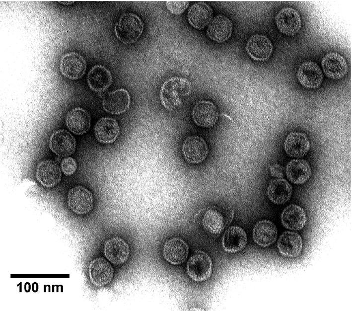 Figure 3: Transmission electronic microscopy of P22 capsids containing cytochrome P450 [112].