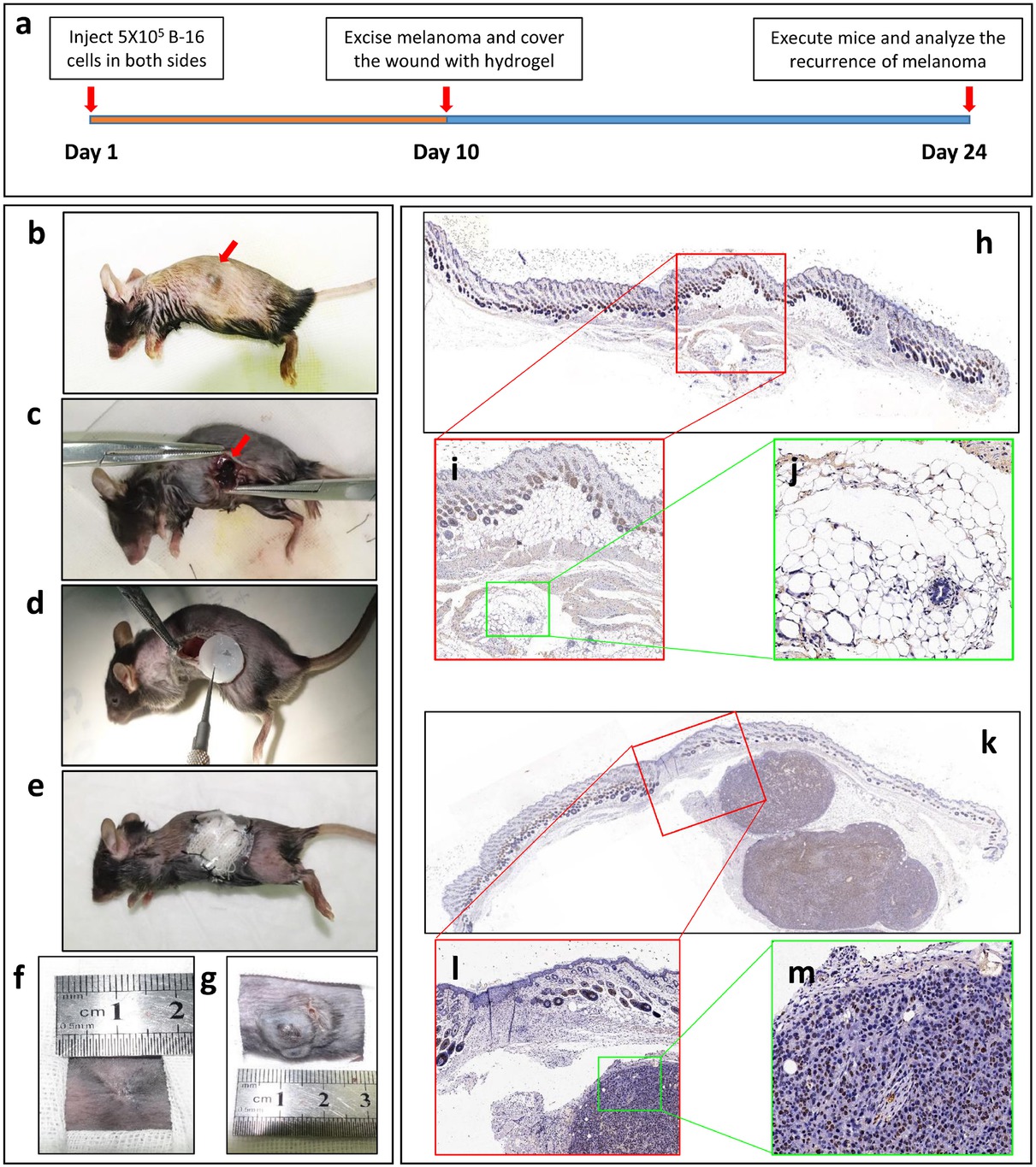 Figure 5 The Yb3+-containing hydrogel inhibits melanoma progression in mouse models. (a) The procedure of the mouse experiment. (b-e) Melanoma cells were injected into both sides of the abdomen in subcutaneous tissues in SD mice. The xenografts were observed approximately 10 days later (b). Both sides of the tumor were incompletely resected (c), and the wounds were covered with an Yb3+-containing hydrogel or a blank hydrogel (d). The wounds were sutured, and the open area remained covered with gauze and a plastic protector (e). The gauze and plastic protector were removed, and the wounds covered with the Yb3+-containing hydrogel (f) and the blank hydrogel (g) were analyzed after 2 weeks to detect the recurrence of melanoma. IHC of ki-67 was carried out on the skin tissues, including the implanted hydrogel (h-j) and relapsed melanoma tissue (k-m)