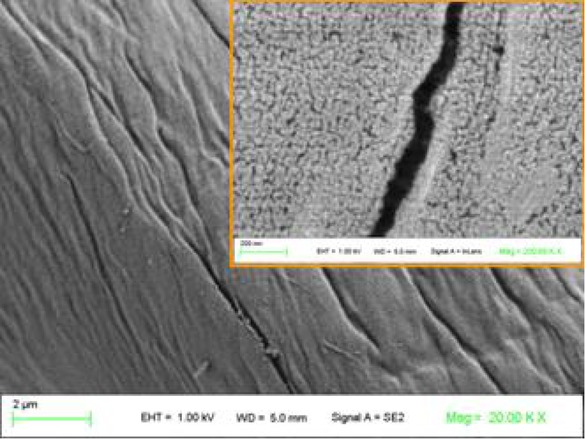 Figure 2 FE-SEM images of cotton fibres covered by a layer of TiO2 NPs after a hydrothermal temperature of 130°C; in the inserted window, a more resolved image shows a thin layer of TiO2 NPs covering the whole cotton surface [24]; reprinted (modified) with permission from Royal Society of Chemistry