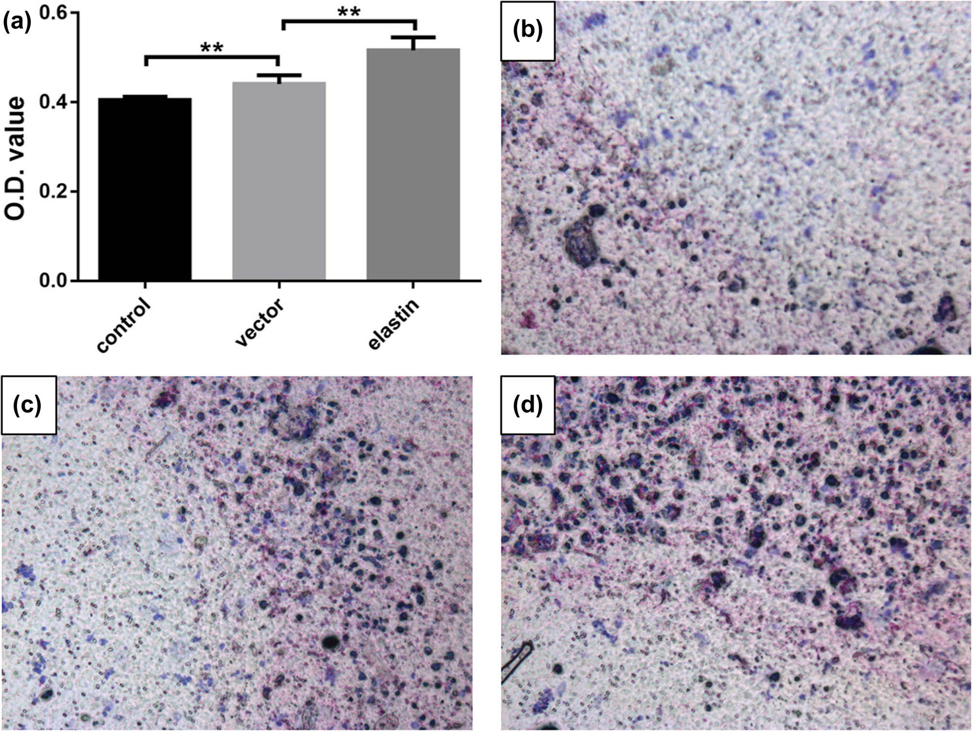 Figure 5 
                  Calculated result of (a) cell invasion, (b) staining images of control, (c) empty vector, and (d) elastin gene-loaded vector groups (×100).
               