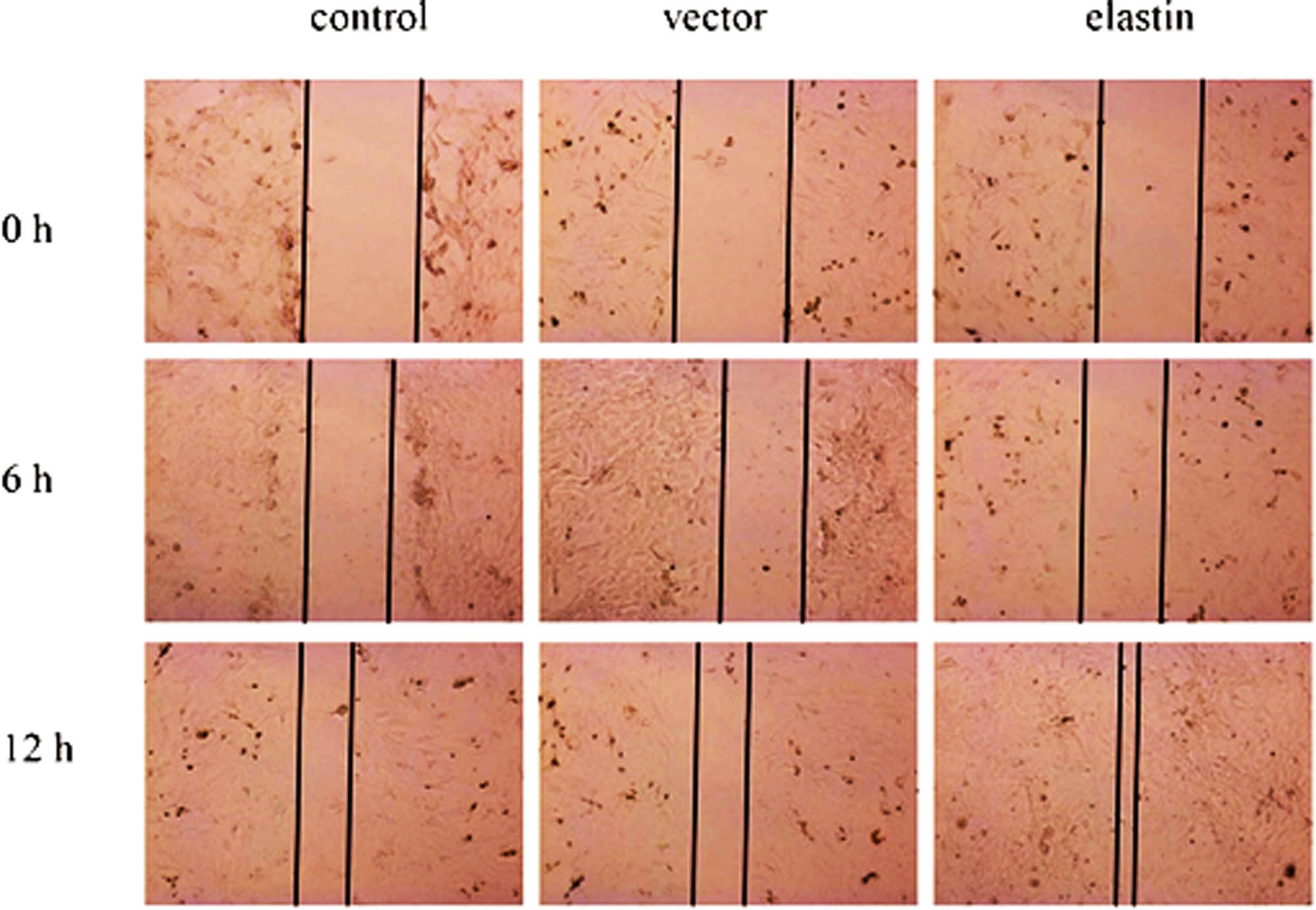 Figure 6 
                  Optical images of BMSC migration with different treatments after incubating for various time periods (×200).
               
