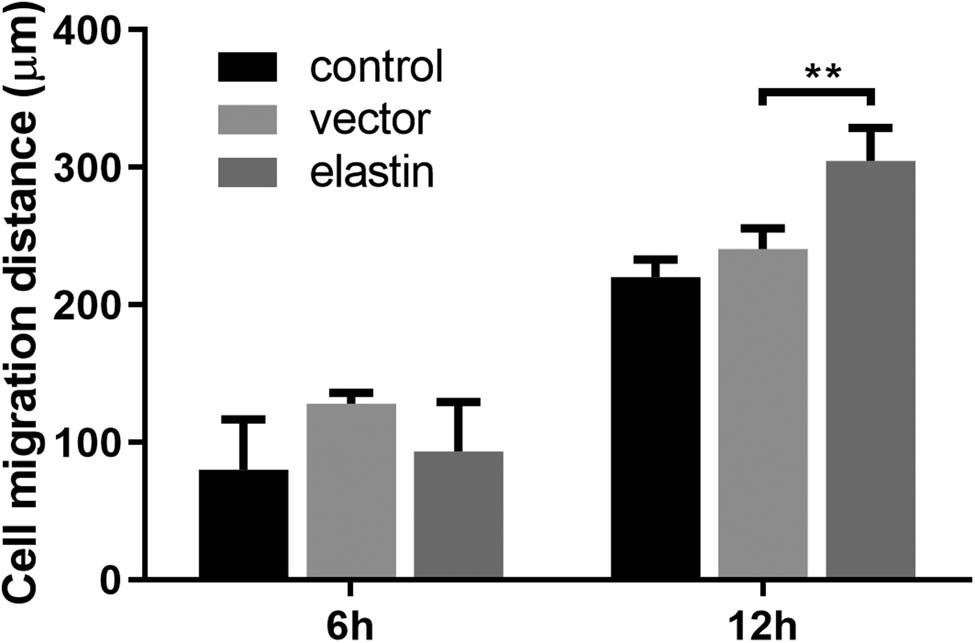 Figure 7 
                  Migration distance calculation of BMSCs with different treatments after incubating for 6 and 12 h.
               