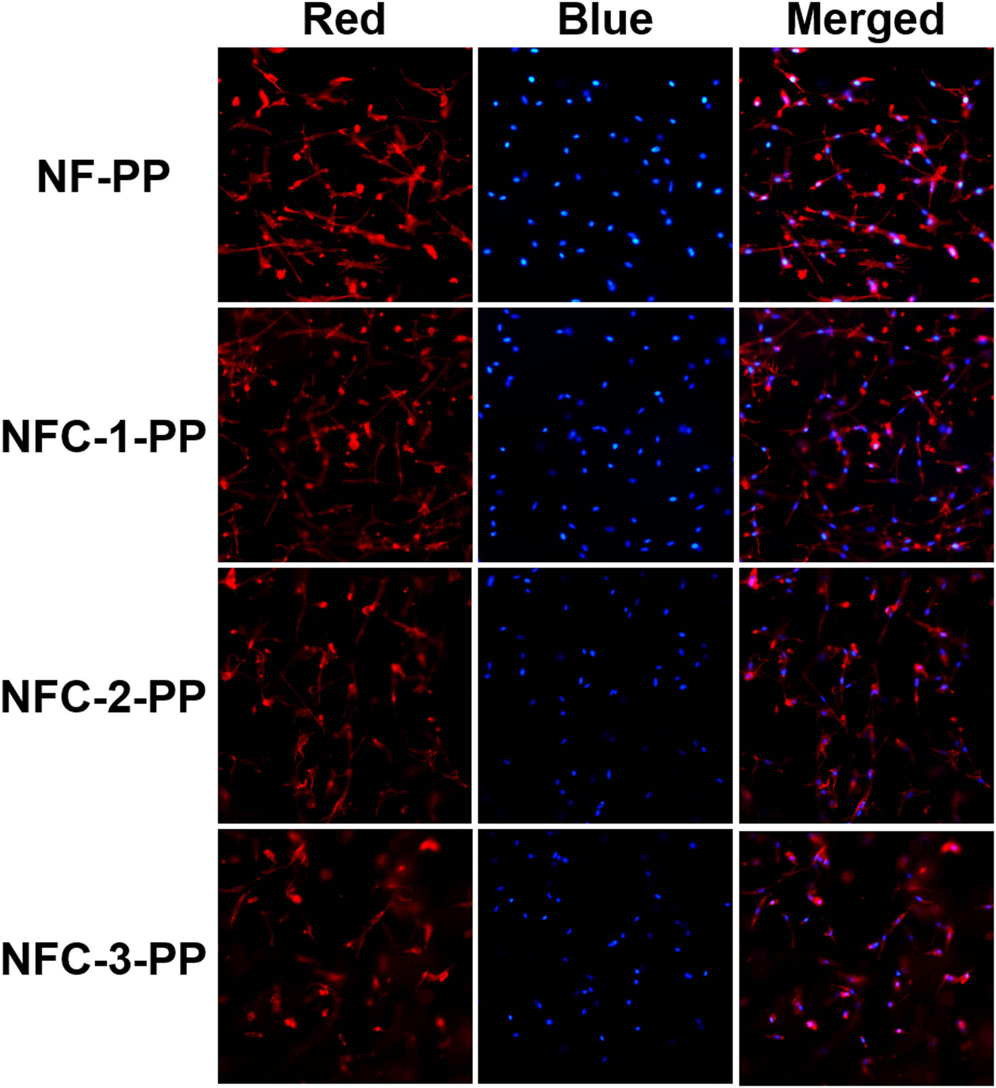 Figure 11 
                  CLSM images of BMSCs seeded on NF-PP and NFC-PP with different CIP concentrations (×200).
               