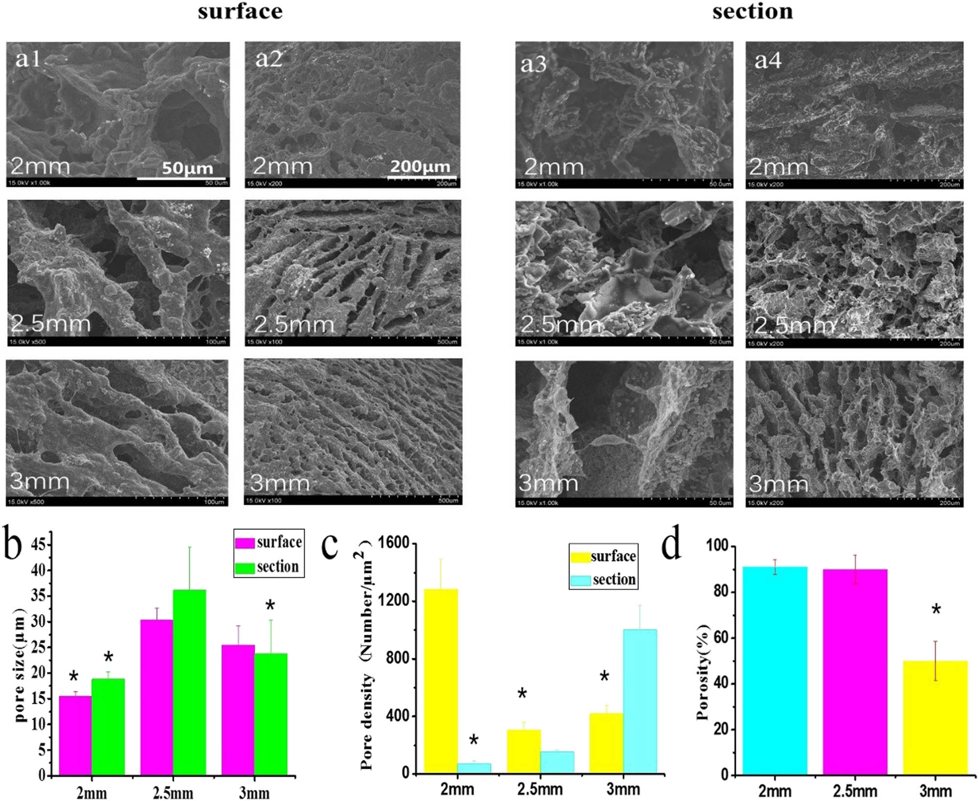 Figure 3 
                  Morphological characterization of GG/ST scaffold. (a) Cross-sectional view of the scaffolds taken by scanning electron microscope; (b) quantitative analysis of the cross-sectional pore size; (c) quantitative analysis of the cross-sectional pore density; (d) porosity test. *p < 0.05 by one-way ANOVA test.
               