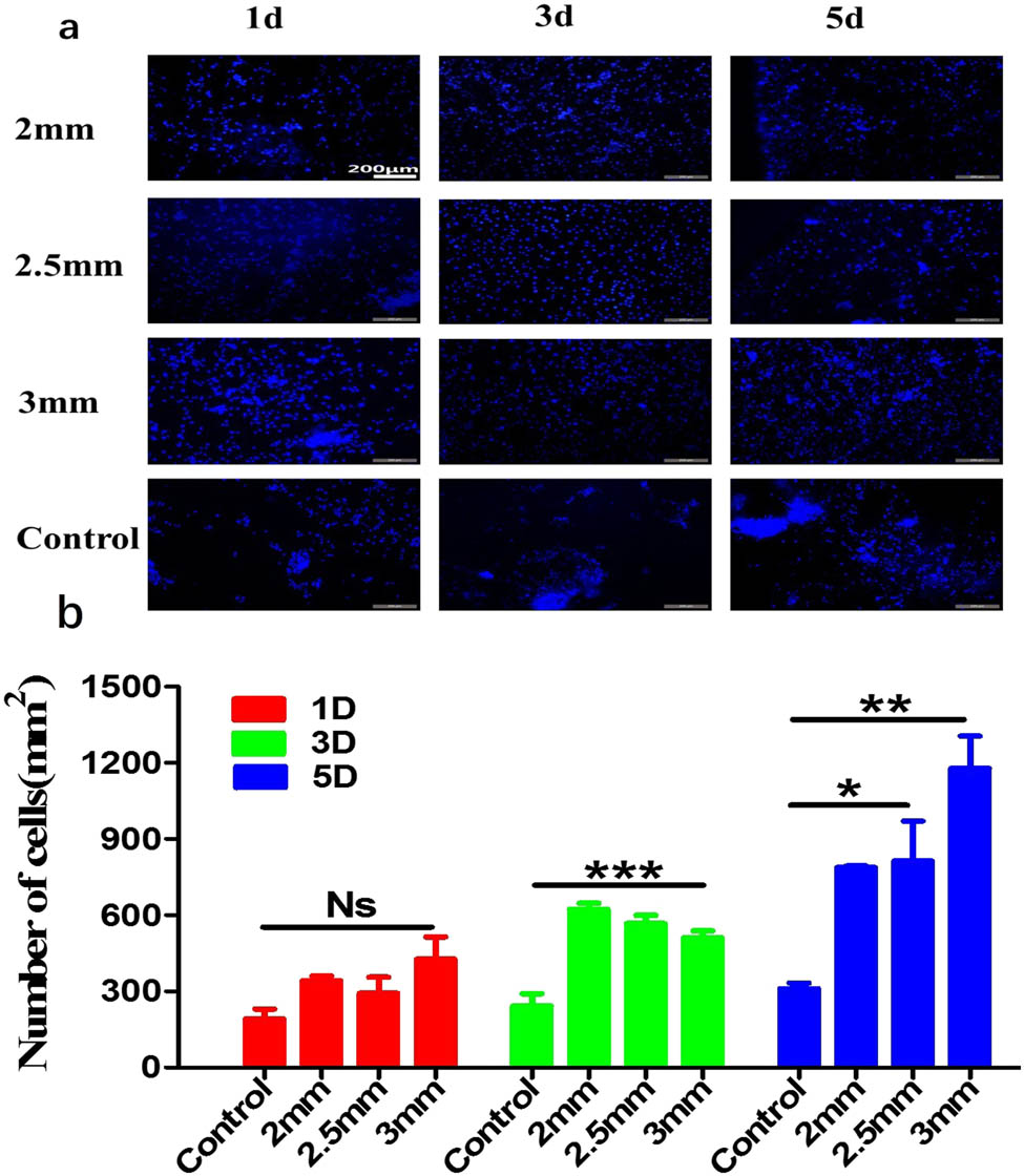 Figure 7 
                  Schwann cells culture. (a) Immunofluorescence images of GG/ST scaffold cocultured with RSC96 cells for 1d, 3d, and 5d. (b) Statistics of cell count results related to immunofluorescence. *p < 0.05, **p < 0.01 and ***p < 0.001 by one-way ANOVA test.
               