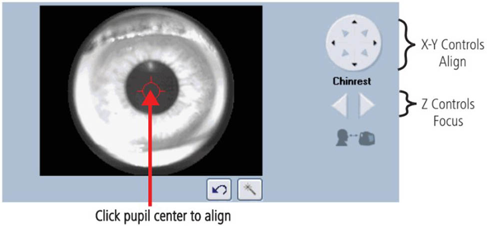 Figure 1 
                  Position control of the OCT scanning beam for the Cirrus HD-OCT machine (Carl Zeiss Meditec, Inc., Dublin, CA). The X–Y panel controls the horizontal and vertical movement of the screening center (red circle). The Z panel controls the focus.
               