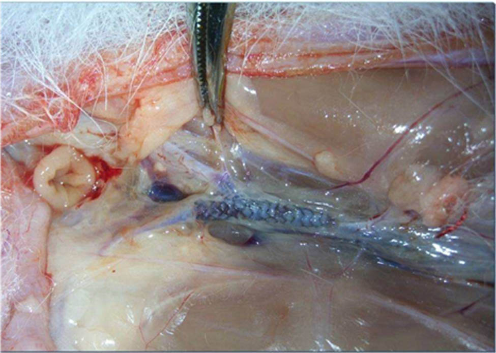 Figure 1 
                  The implantation position of nitrided iron stent in a rabbit.
               