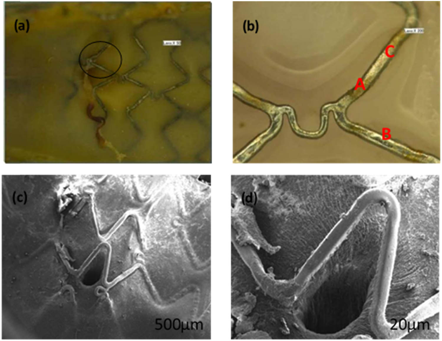 Figure 2 
               Rabbit iliac aorta with degradable iron stent after 1-month implantation. (b) is the scale-up diagram in (a); (d) is the scale-up diagram in (c).
            
