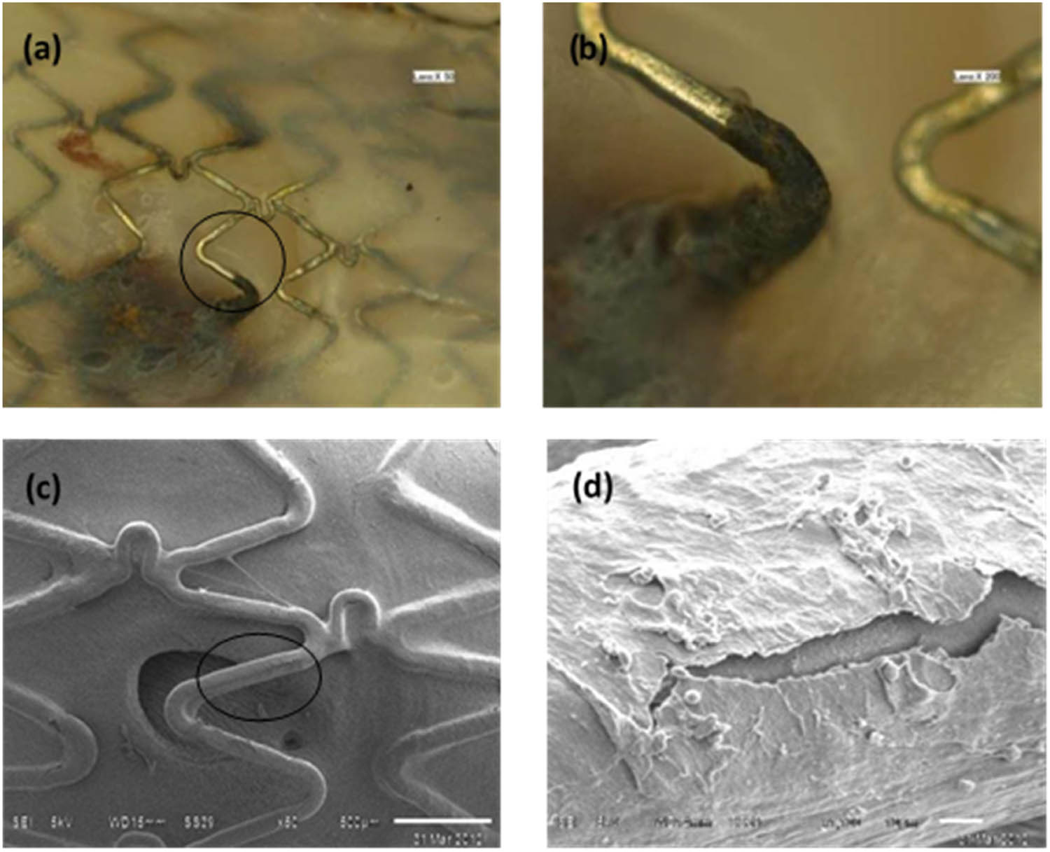 Figure 3 
               Rabbit iliac artery with degradable iron stent after 3 months implantation. (b) is the scale-up diagram in (a); (d) is the scale-up diagram in (c).
            