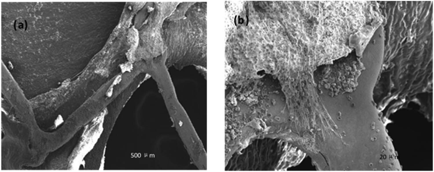 Figure 4 
               Rabbit iliac artery with degradable iron stent after 9 months implantation. (b) is the scale-up diagram in (a).
            