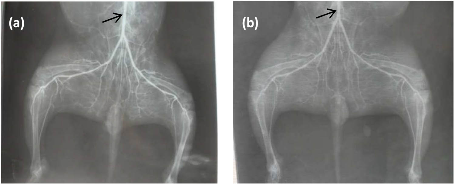 Figure 5 
               Rabbits’ downstream vessels’ X-ray morphology with a degradable iron stent at the iliac artery position: (a) 3 months after implantation; (b) 9 months after implantation, arrow position stand for the position of the implanted stent.
            