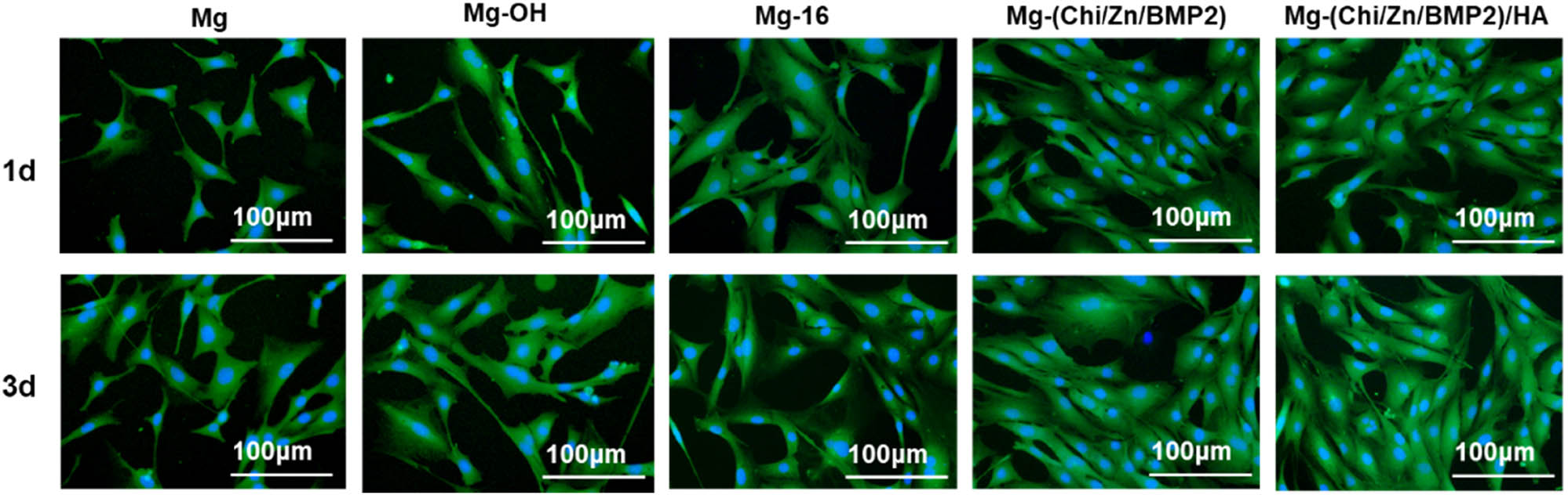 Figure 5 
                  Fluorescence staining of osteoblasts on different surfaces after being cultured for 1 and 3 days, respectively (green: cytoplasm, blue: nucleus).
               